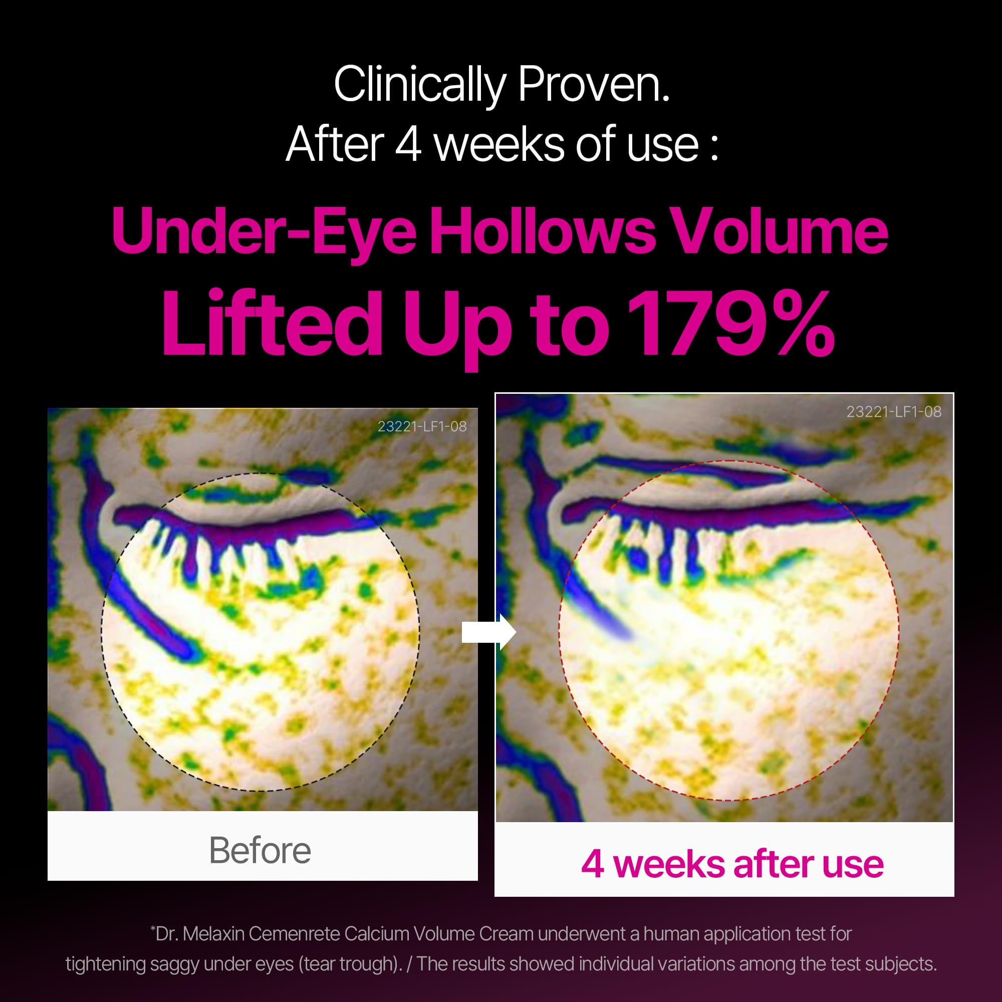 Dr.Melaxin CEMENRETE EYE CREAM