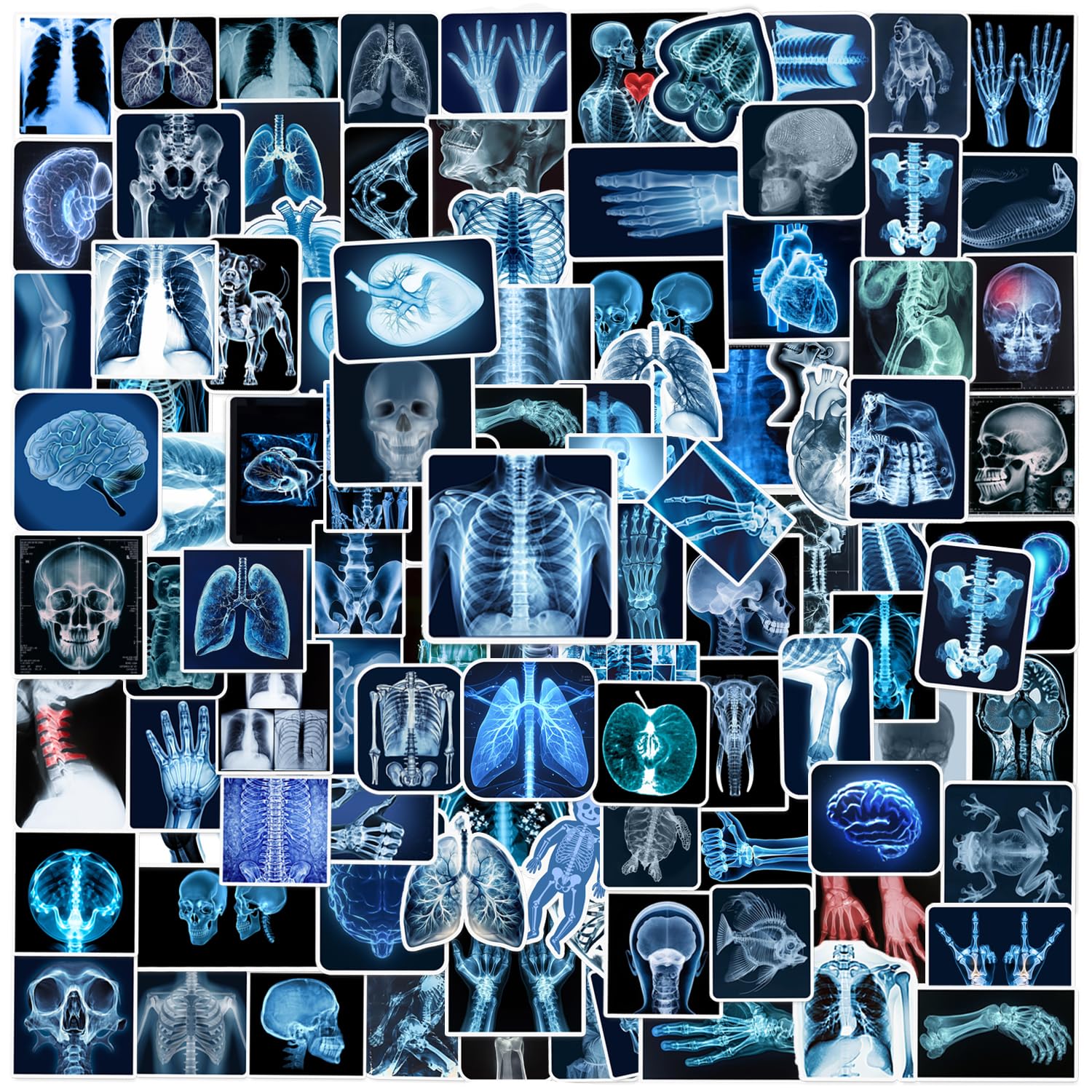 110PCS Radiology X Ray Stickers, Radiology Party Favors Birthday Party Decorations Vinyl Waterproof Stickers for Water Bottle Laptop Luggage Xray Tech