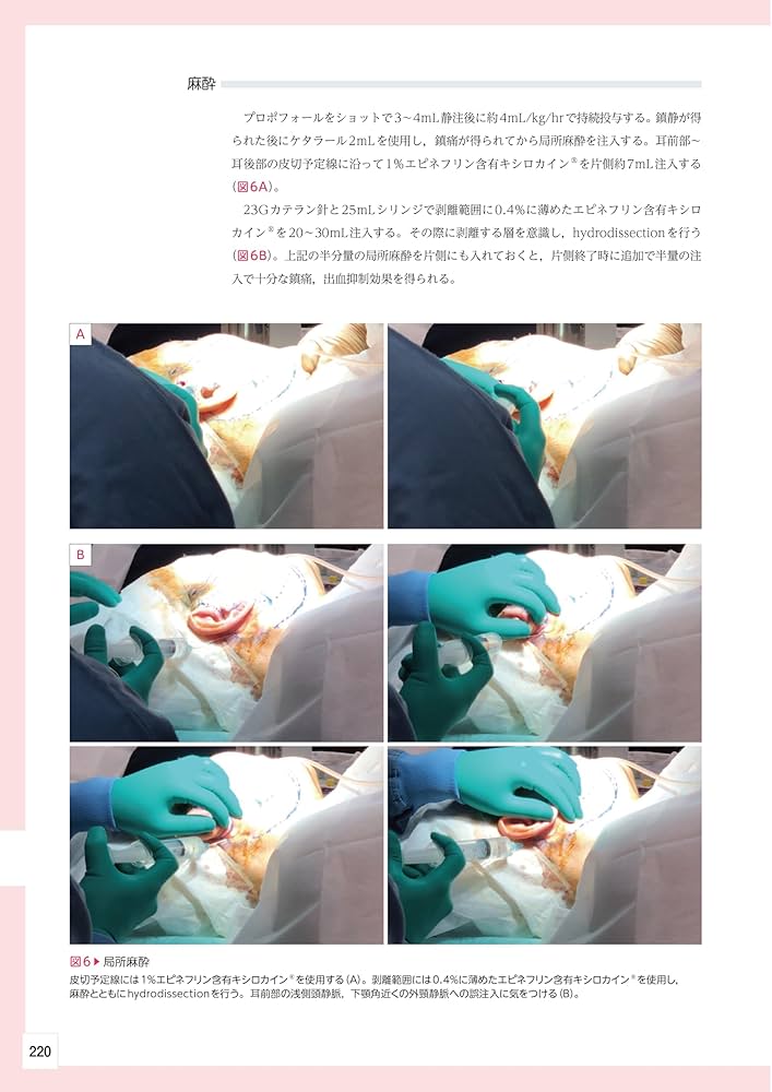 顔の美容外科手術 第2版 | 飯田秀夫 |本 | 通販 | Amazon