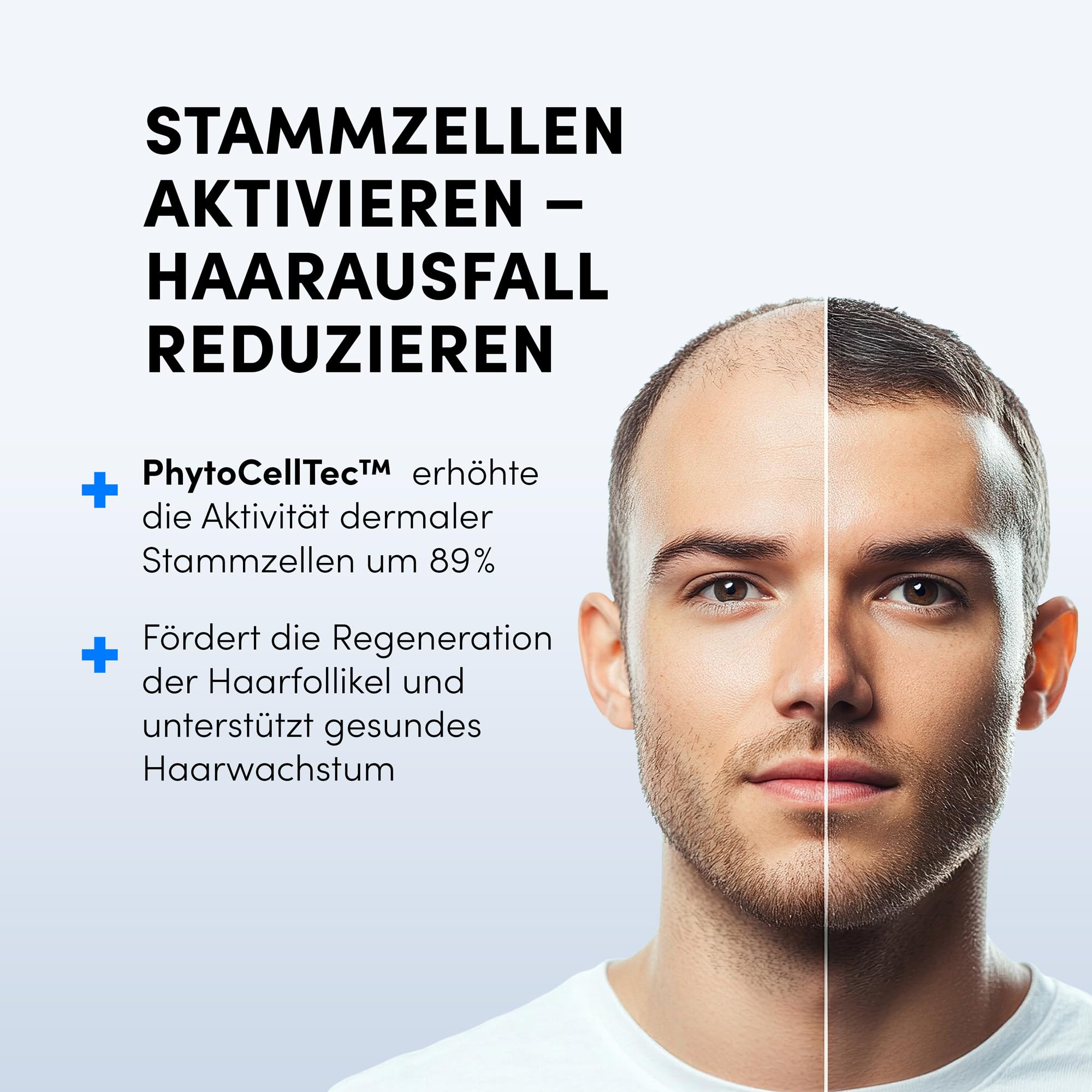 Dr. Balwi Microneedling-Roller & Hair Growth SerumSet – Anti Haarausfall, stärkt Haarwurzeln, fördert Haarwachstum mit Procapil & Stammzellen, ohne Silikone & Parabene, 10x6ml Flacon