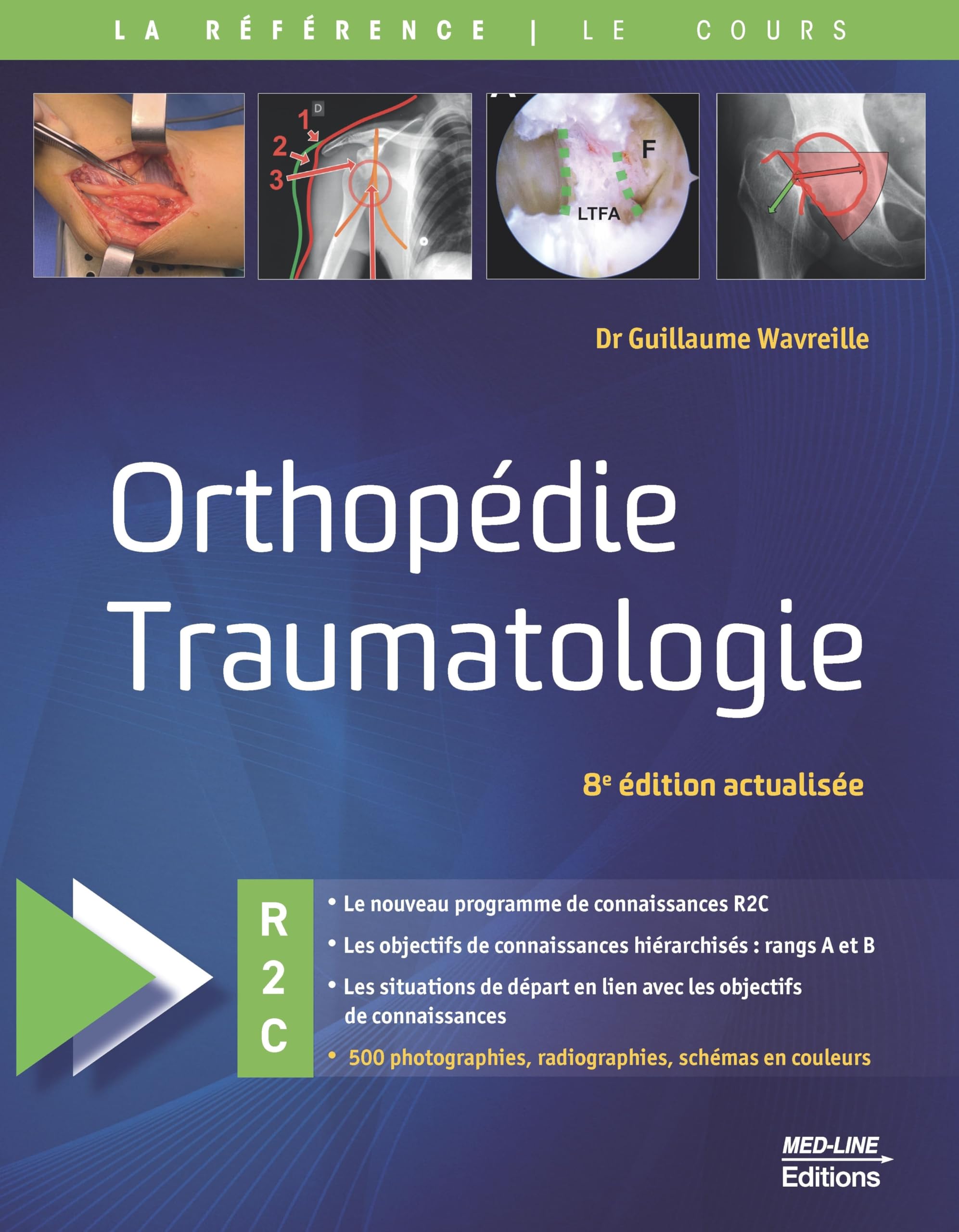 Orthopédie traumatologie