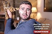 Vista 1 de gel de cicatriz de silicona para el retiro de cicatrices, terapia de cicatrices - tubo 1.06 oz