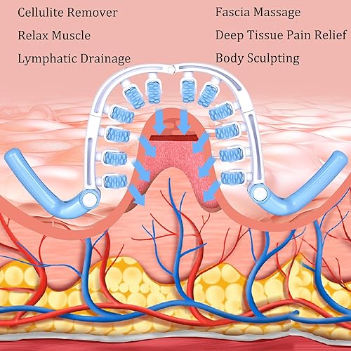 Miniatura 6 de Rodillo de masaje para celulitis, herramienta para eliminar la celulitis para muslos, cintura, piernas, pantorrilla, drenaje linfático, masaje de