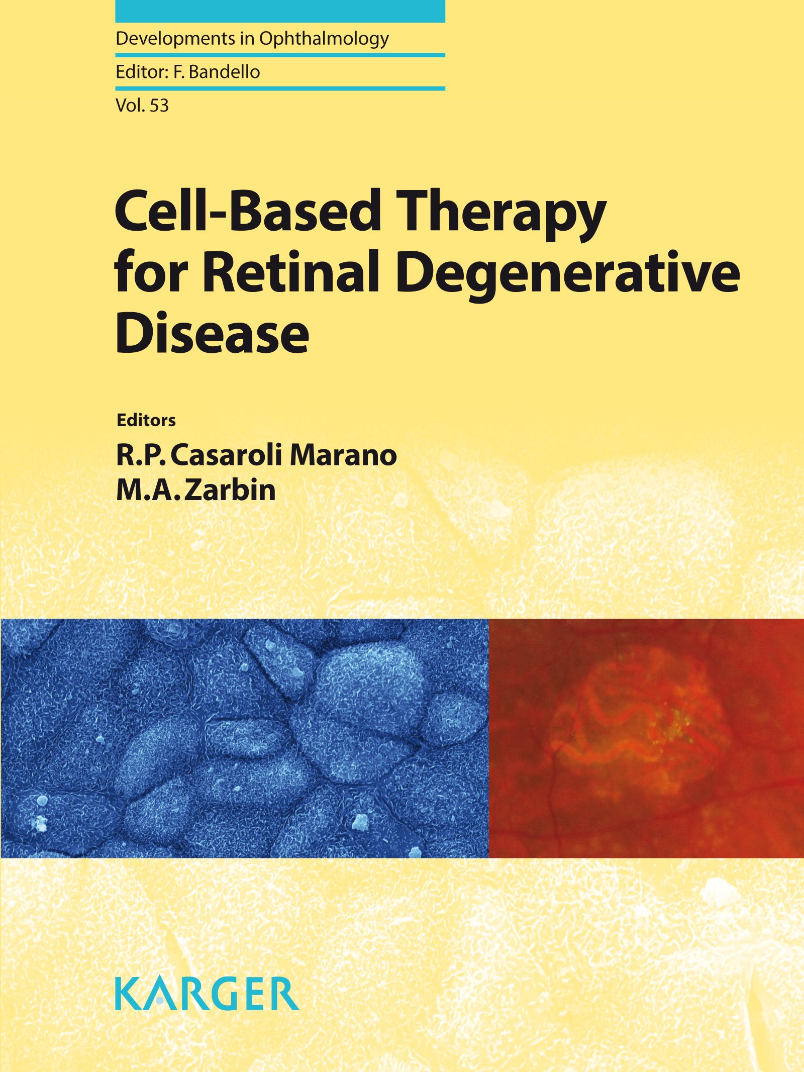 Cell-Based Therapy for Retinal Degenerative Disease (Developments in Ophthalmology Book 53)