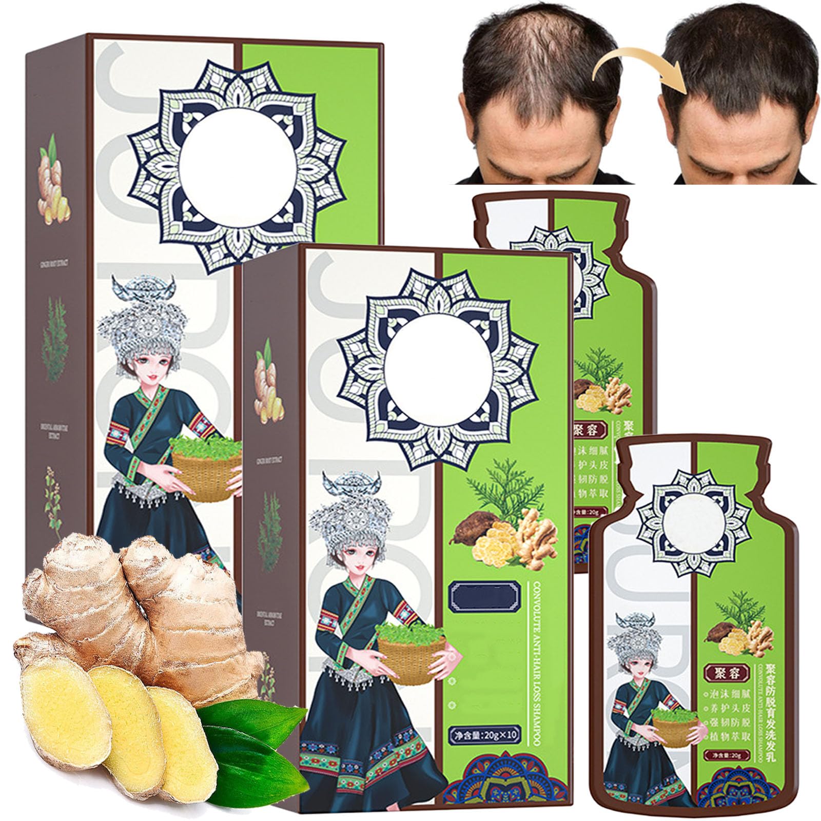 Amazon.com : Ginger Plant Extract Hair Shampoo for Anti-Hair Loss