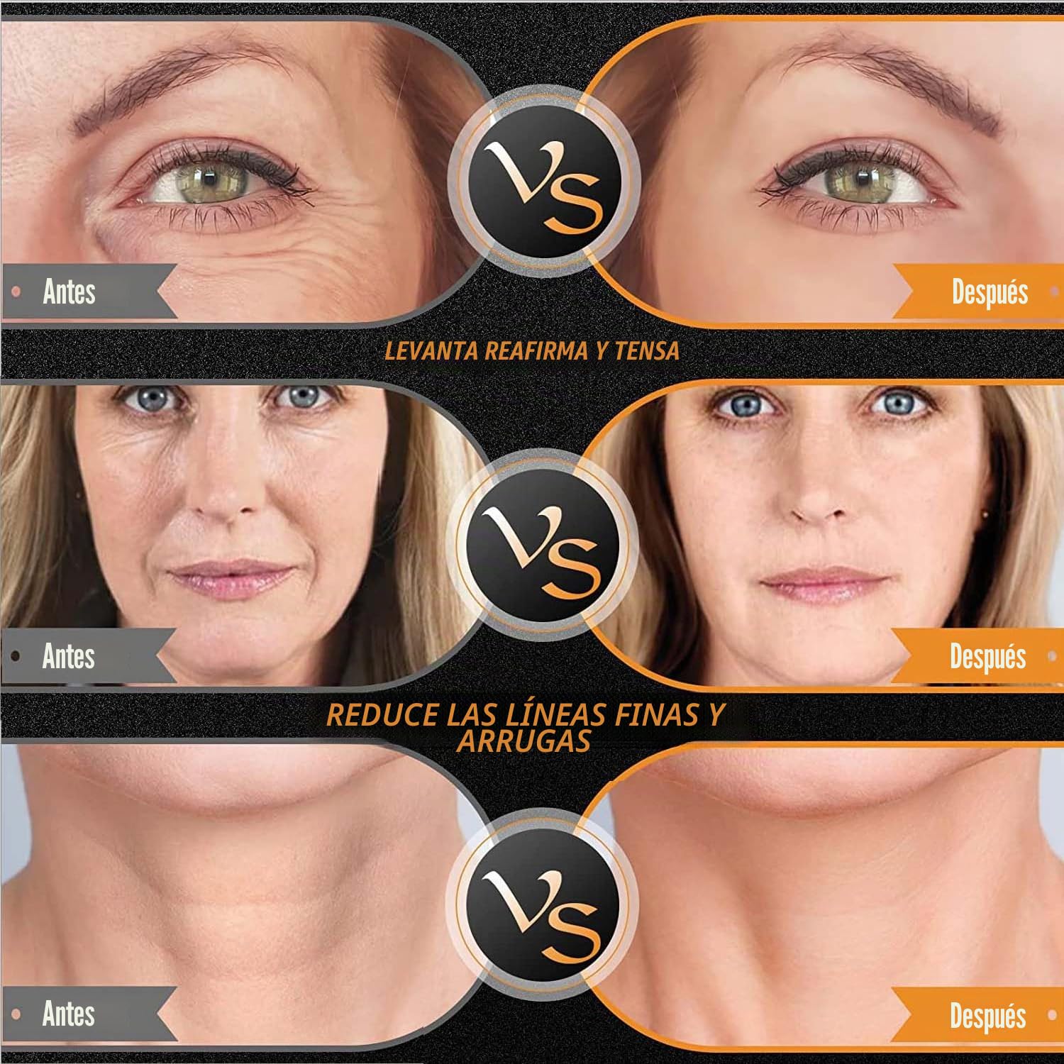 Elitzia Máquina facial de radiofrecuencia RF y EMS, uso doméstico, máquina de estiramiento de la piel, 3 tamaños, reemplazo de cabeza, levantamiento facial, reducción de arrugas, rejuvenecimiento de