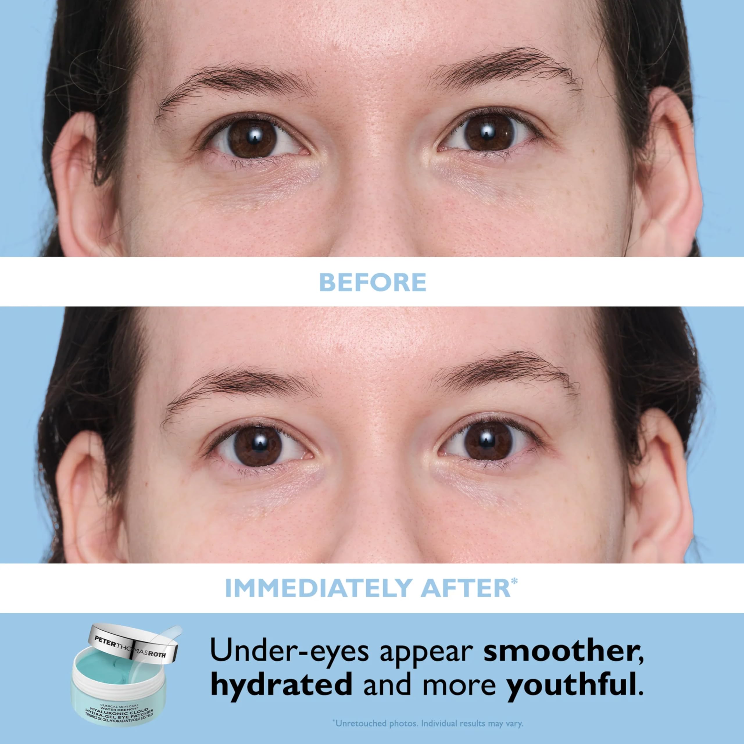 Peter Thomas Roth Water Drench® Essentials 2-Piece Set – Hyaluronsäure Feuchtigkeitsset mit Cloud Cream & Eye Patches – Intensive Hydration für Gesicht & Augen – Anti-Aging Pflege