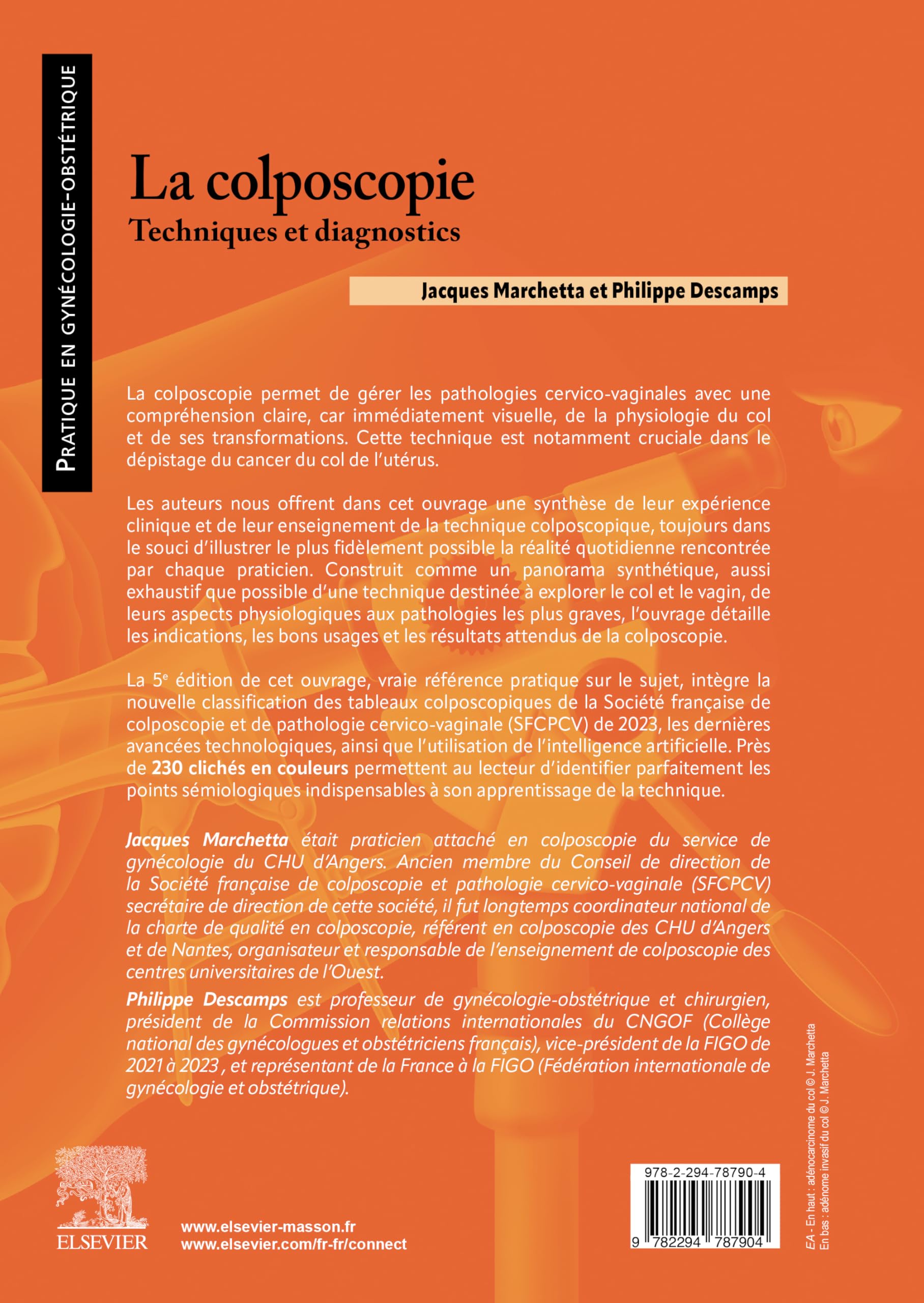 La colposcopie: Techniques et diagnostics