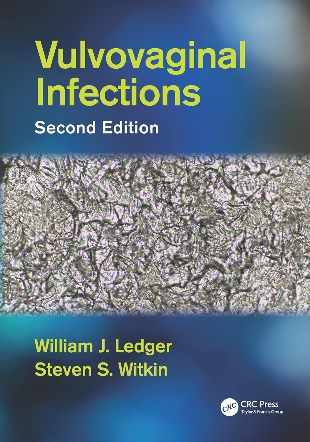 Vulvovaginal Infections      Kindle Edition