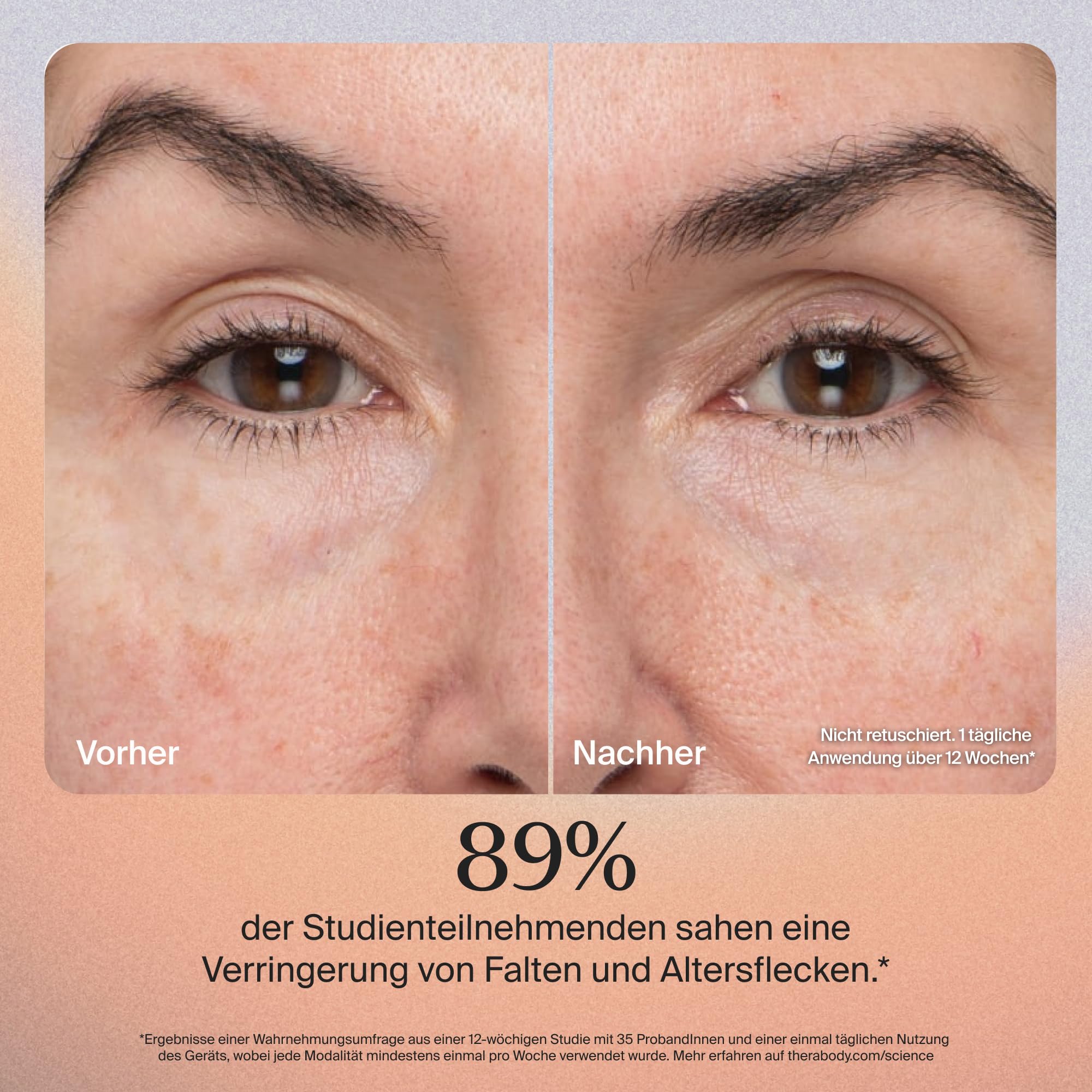 TheraFace PRO – Handgerät zur Gesichtsmassage – Kompaktes elektrisches Gerät zur Gesichts- und Hautpflege – 8-in-1-Behandlung mit Mikrostrom- und LED-Ringen – 4. Generation – Schwarz