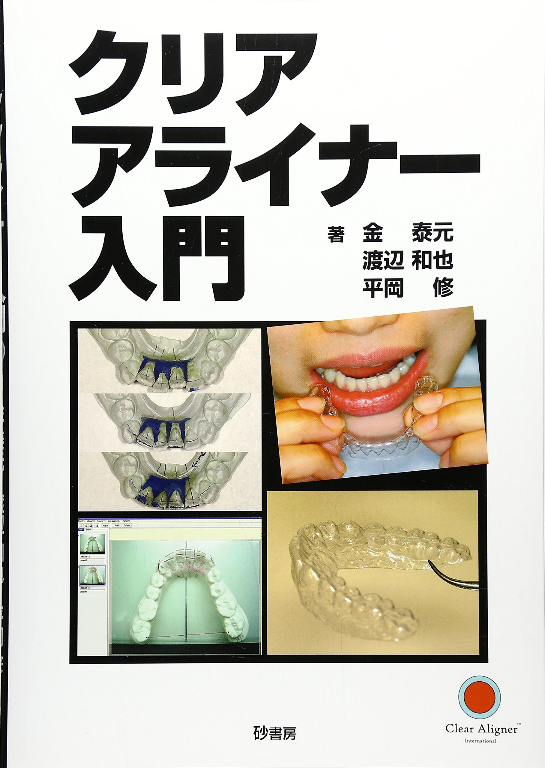 クリアアライナー入門 金 泰元 Amazon.co.jp: クリアアライナー入門 : 金 泰元: 本