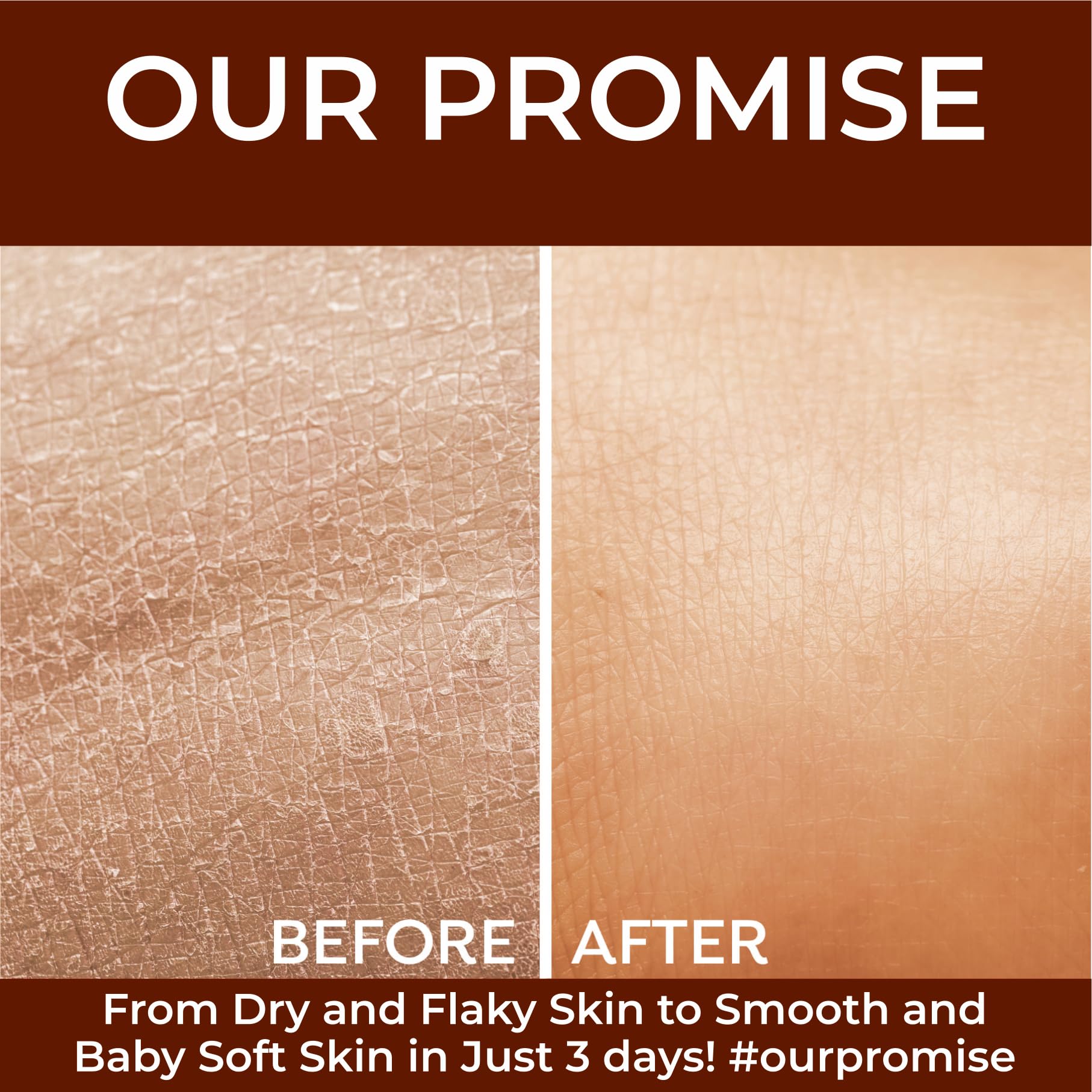 Bee One Almond Rich Moisturizer 1000ml, Deep Nourishment Lotion with 24H Moisture Lock & All-Day Protection, Transforms Dry & Flaky Skin to Smooth, Baby Soft & Glowing, All Skin Types, Men & Women 4