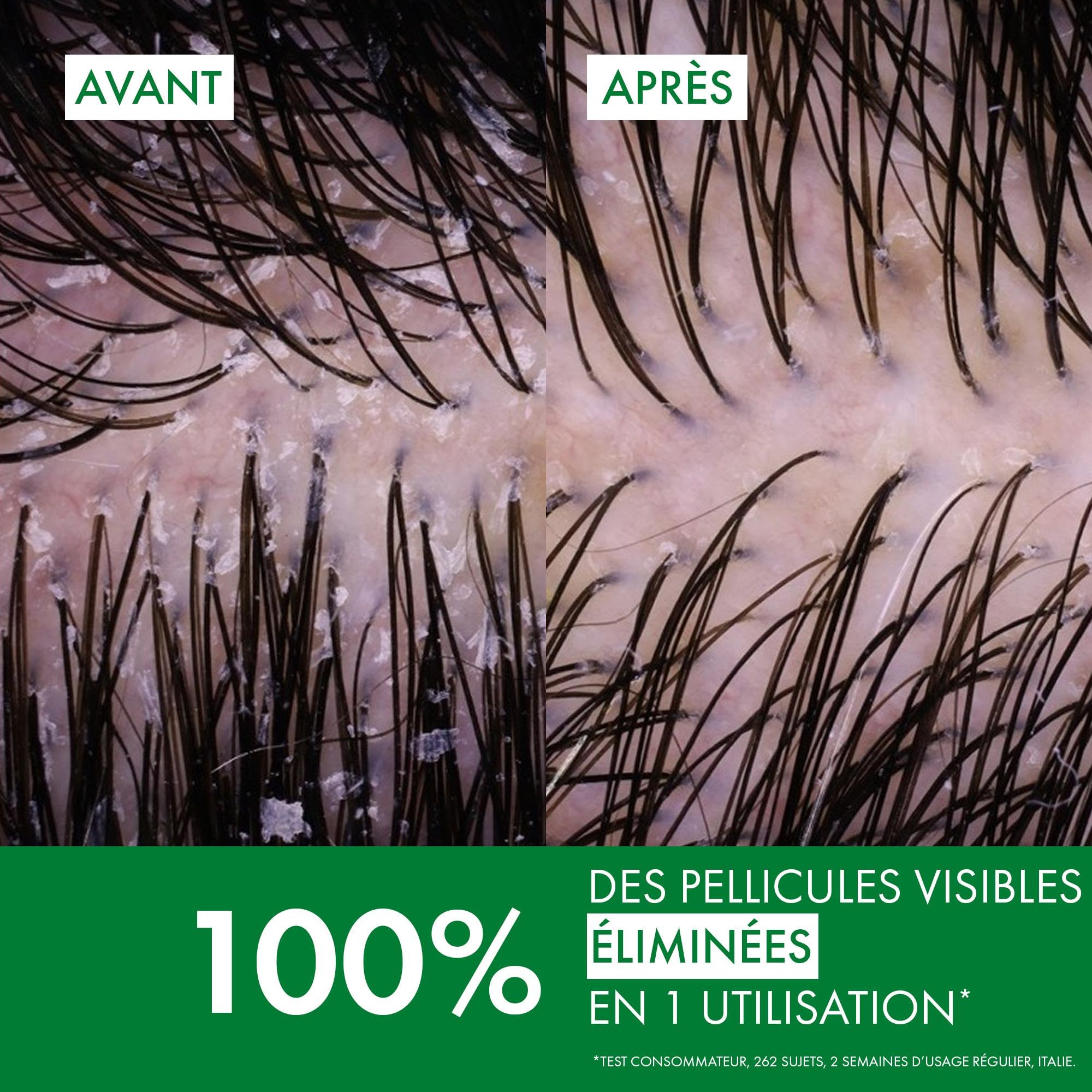 Vichy, Dercos, Shampooing Anti-Pelliculaire DS, Pellicules & Démangeaisons, Cheveux Secs