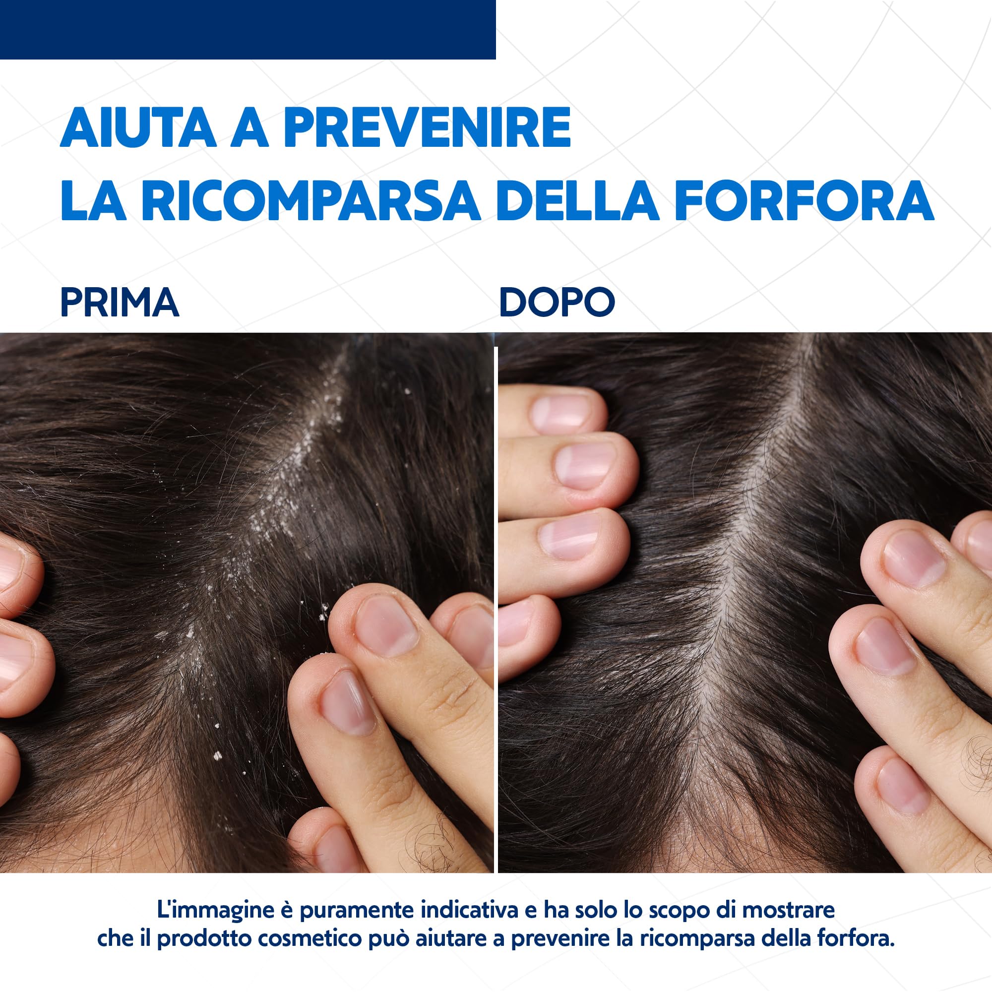 EG Nizoral Care Shampoo Cute e Capelli Grassi | Protezione Continua da Forfora e Prurito | Azione 3 in 1 Clinicamente Testata| 200 ml