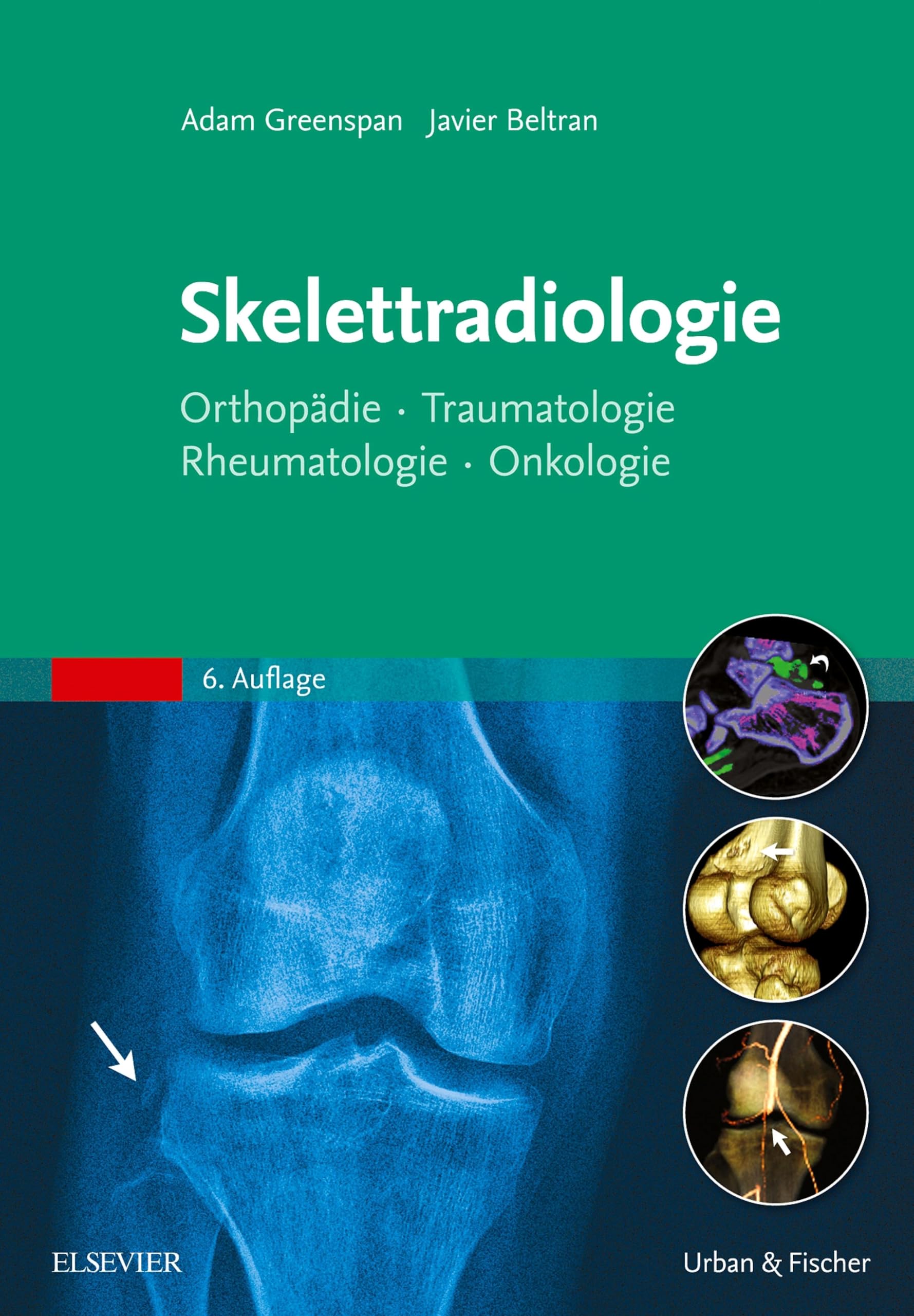 Skelettradiologie: Orthopädie, Traumatologie, Rheumatologie, Onkologie (MONOGRAPHIE - Fachbuch - Urban & Fischer-Verlag)