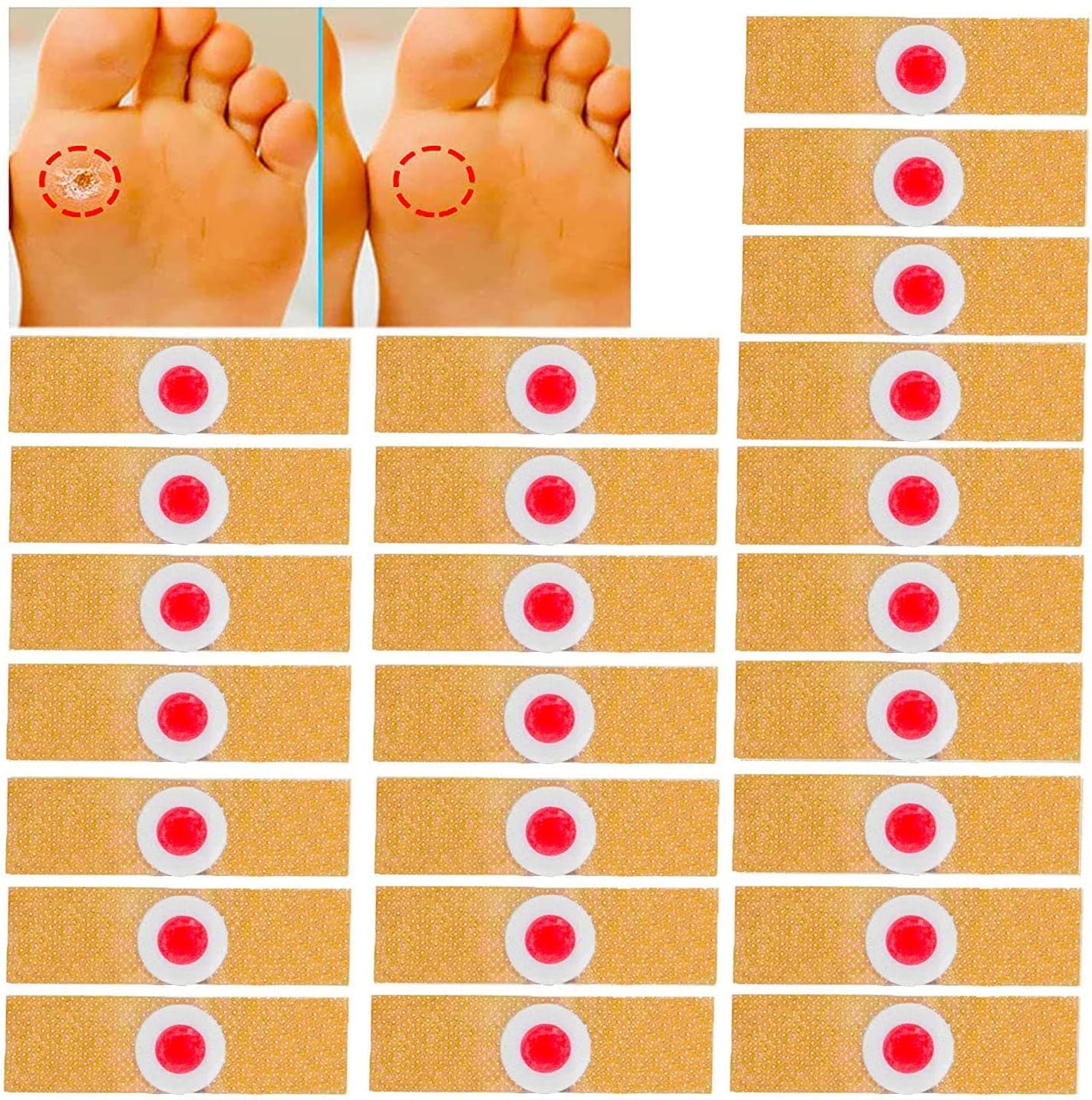 WROXTY 10 Pcs Foot Corn Removers Plaster with Hole,for Feet,Wart Remover, Wart Removal Plasters Pad,Feet Callus Remove, Soften Skin Cutin Sticker Cure Toe Protector (Pack of 1)-image-43