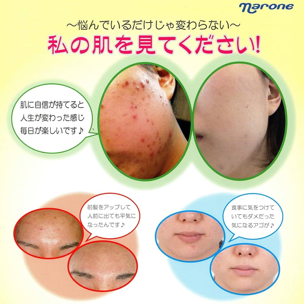 ナローネ　オストリッチAGローション 150mL 2本セット Amazon | ナローネ オストリッチ AGローション 150ml 化粧水