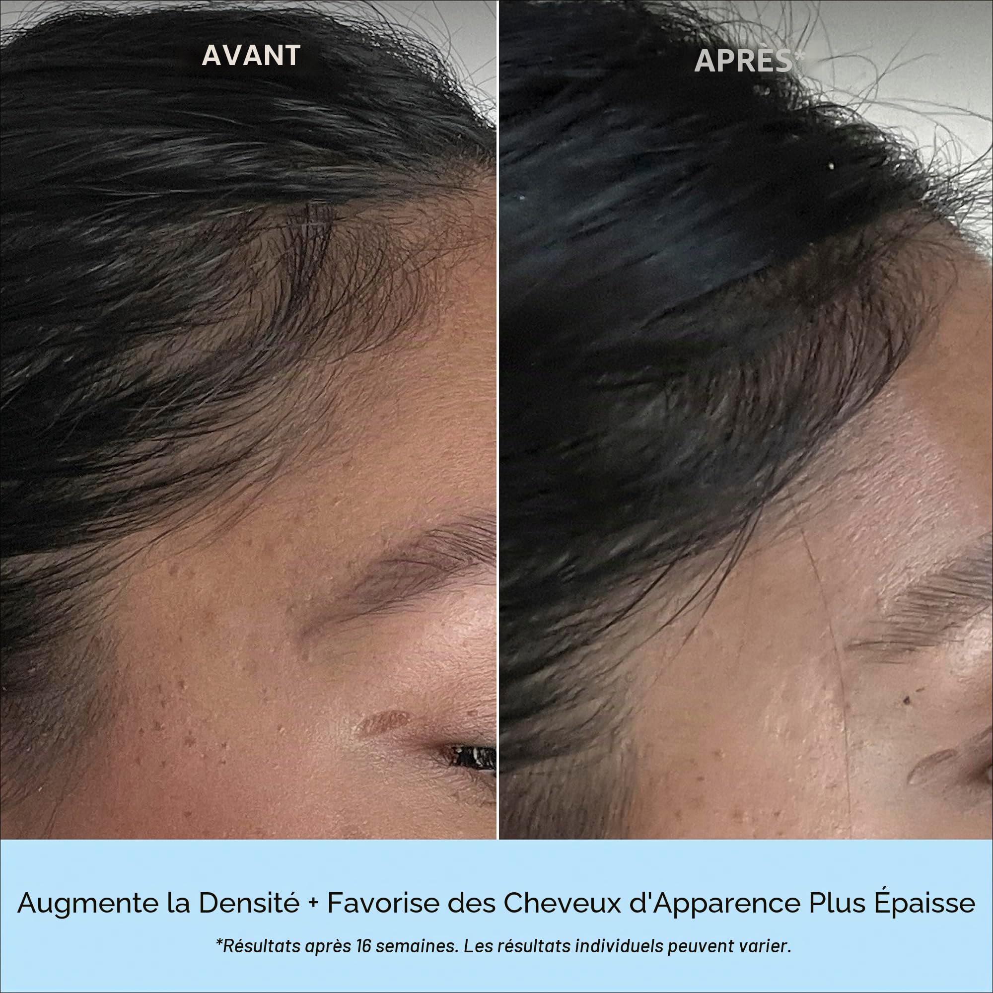 Briogeo Sérum de densité MegaStrength + caféine + biotine peptide | Augmente l'épaisseur et la densité des cheveux, absorption rapide et non gras | Végétalien, sans phtalate et sans parabène | 45 ml