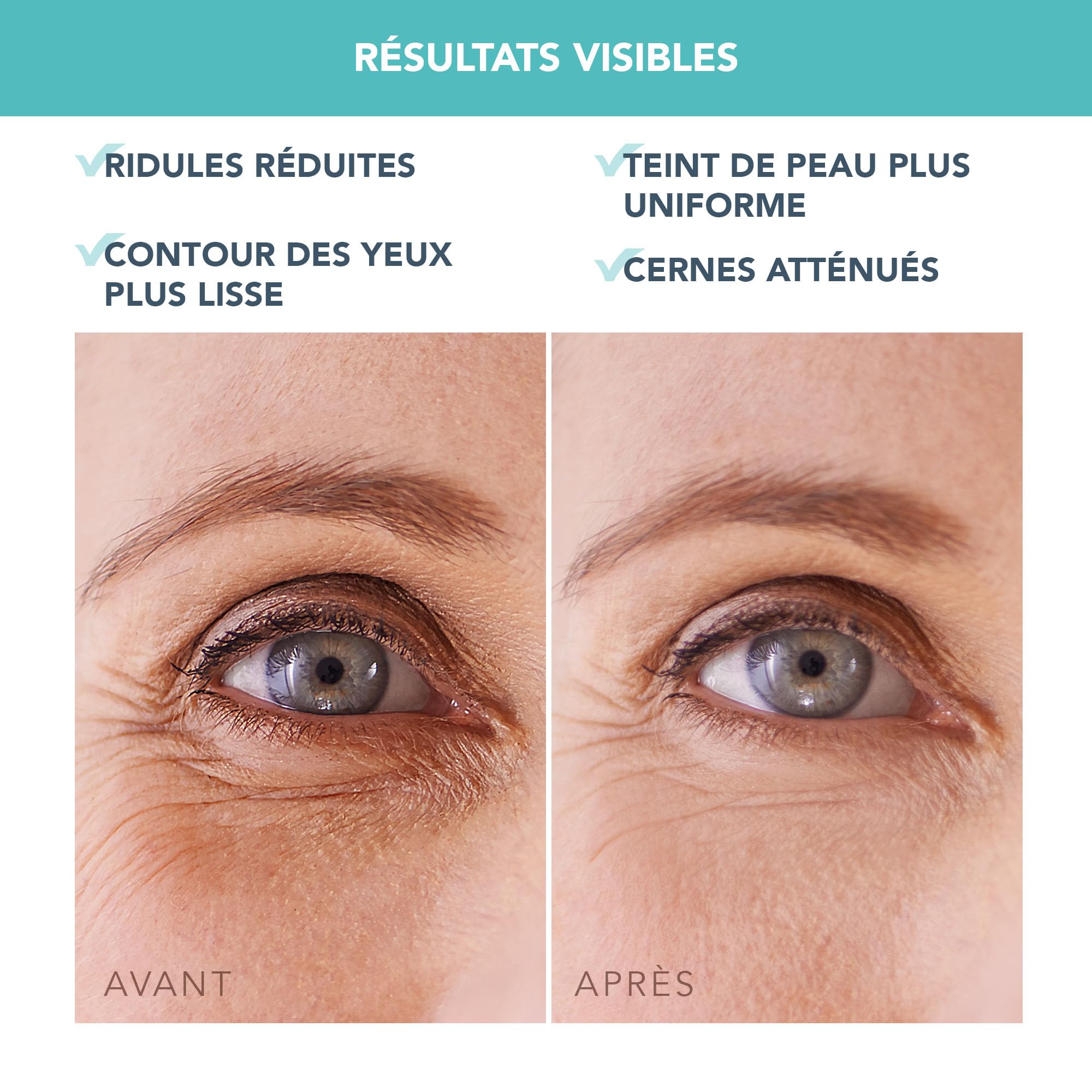 FOREO Eye Revive IRIS 2 Set - Masseur yeux drainage lymphatique + Masque yeux hydrogel hydratant, 60 pc- Soin contour anti-cernes et poches - Soin contour