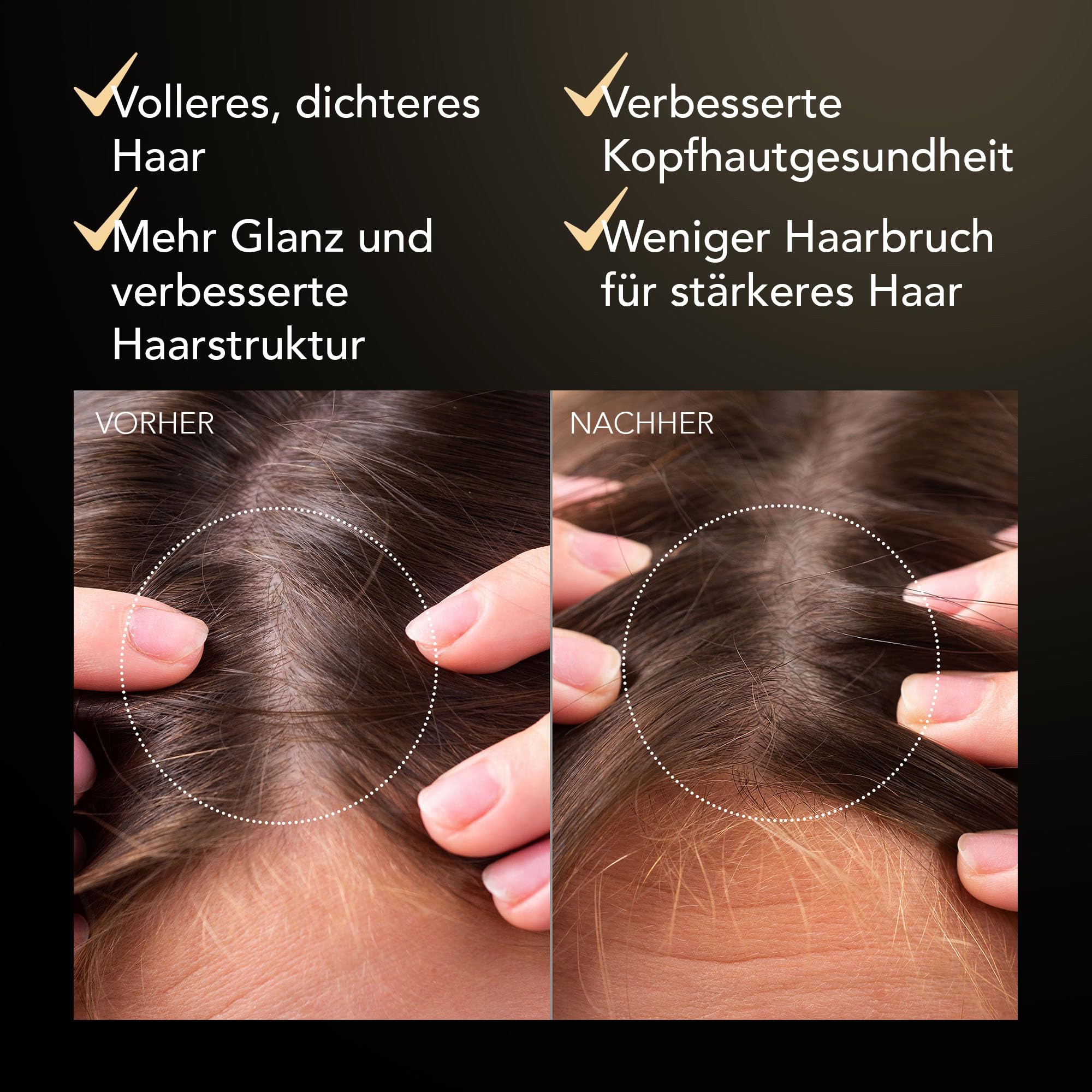 FAQ Kopfhaut-Repair & Thick Hair Probiotika-Serum mit Centella | Haarwachstumsserum, Kopfhautserum, Probiotika, Rotklee, Centella Asiatica, Haarverdichtung, Dünner Werdendes Haar, Vegan