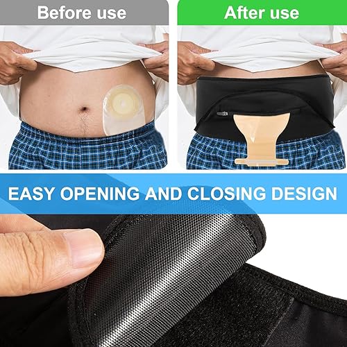 Miniatura 5 de Cinturón de ostomía  Funda para bolsa de ostomía  Envoltura de ostomía para deporte y natación  Cinturones de apoyo para ostomía para hombres y