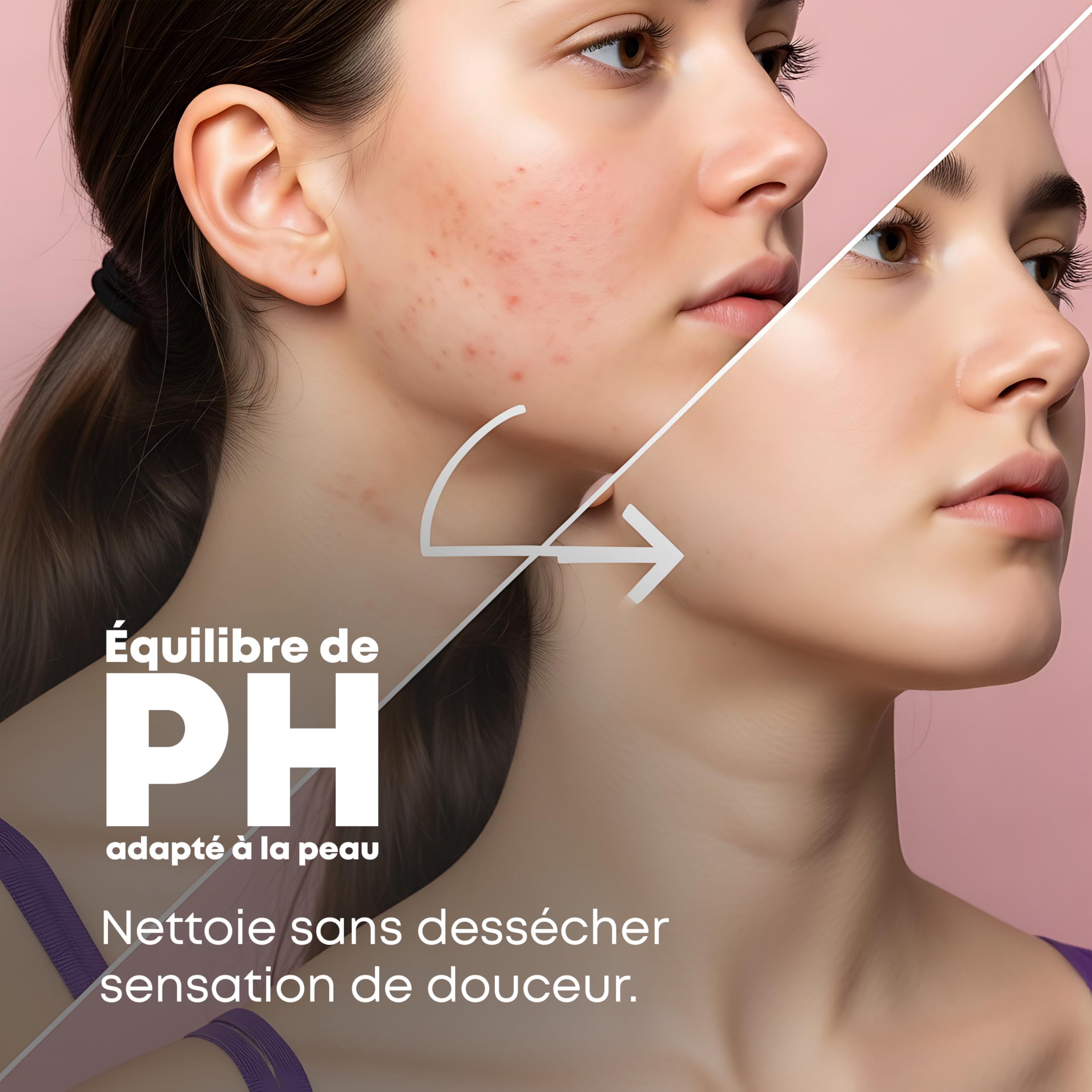PhytoFlora Savon Lait de Chevre|125g|Traitement Anti-Acné, Eczéma et Points Noirs|Shampoing Solide|Gommage Visage|Savon le Naturel|Tous Peaux|ProvitamineB5