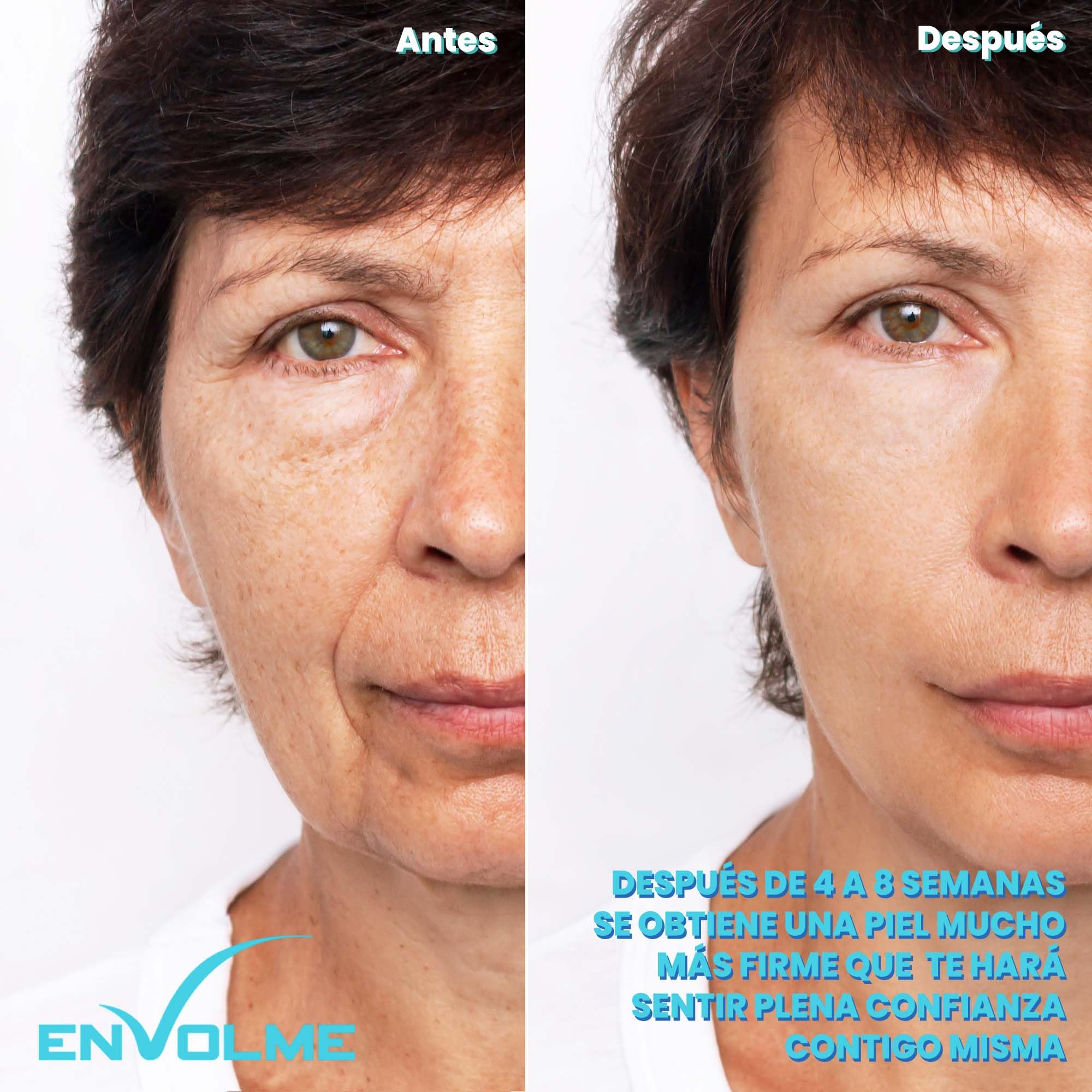 Skin Radiofrequenza Viso - Massaggiatore per Viso - Massaggiatore Viso Lifting - Collagene viso - Ultrasuoni Viso - Beauty Tool - Luce Rossa Terapia -