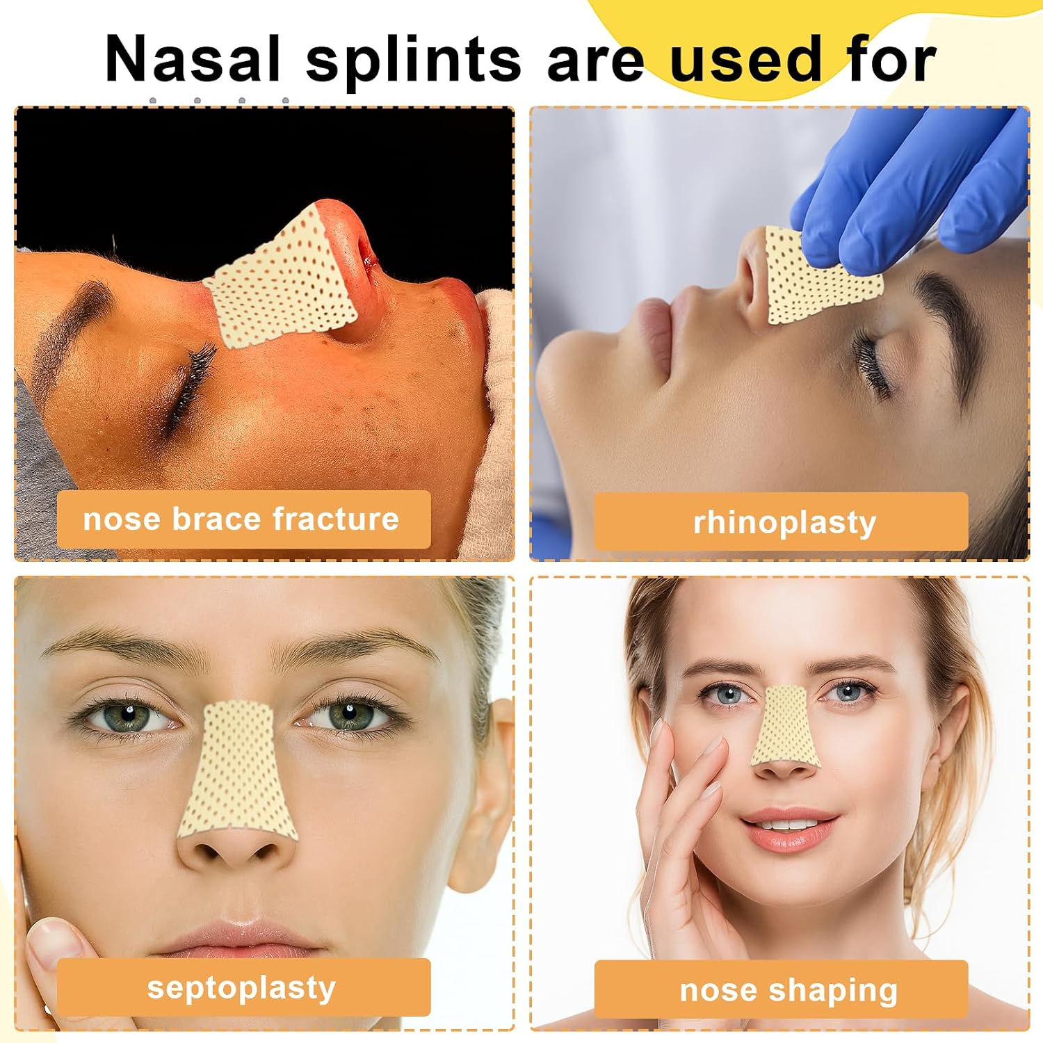 5 Pcs Thermoplastic Nasal Splint with Nose Tape, Reusable Nose Straightener, External Nose Protector Support for Nose Brace Fracture, Rhinoplasty Septoplasty Surgery, Nose Job Recovery Supplies