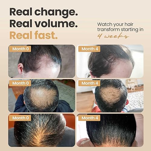 Miniatura 3 de Potenciador de cabello para mujeres y hombres, suero revitalizante para el cabello con capilia longa y arginina para cabello grueso, seco, largo y