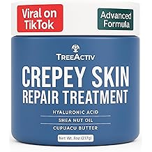 TreeActiv Crepey Skin Repair Cream Original Formula, 8 fl oz, Firming Cream For Face & Neck, Skin Firming Lotion with Hyaluronic Acid, Crepey to Address Dry Crepe