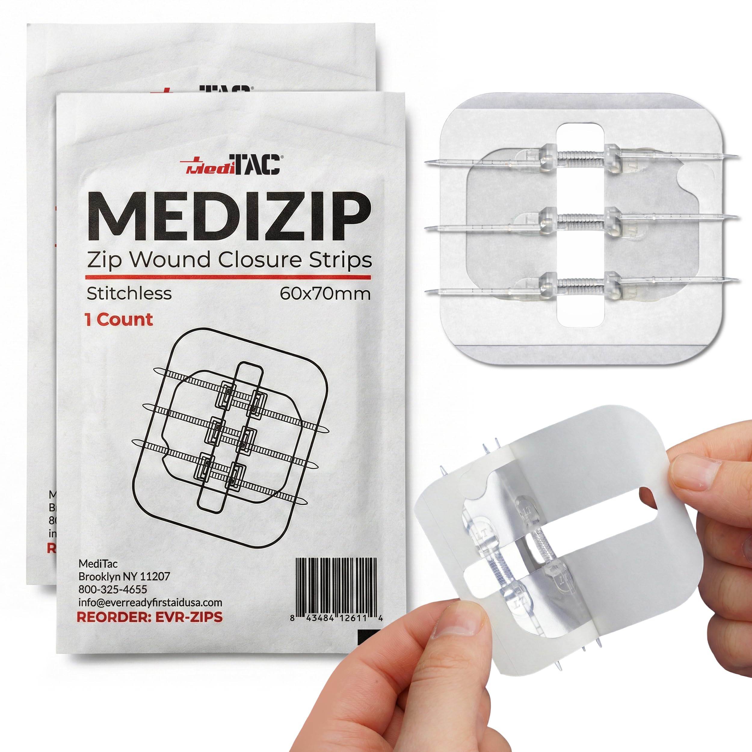 Amazon.com: Stitchless Zip Wound Closure Strips for Cuts and