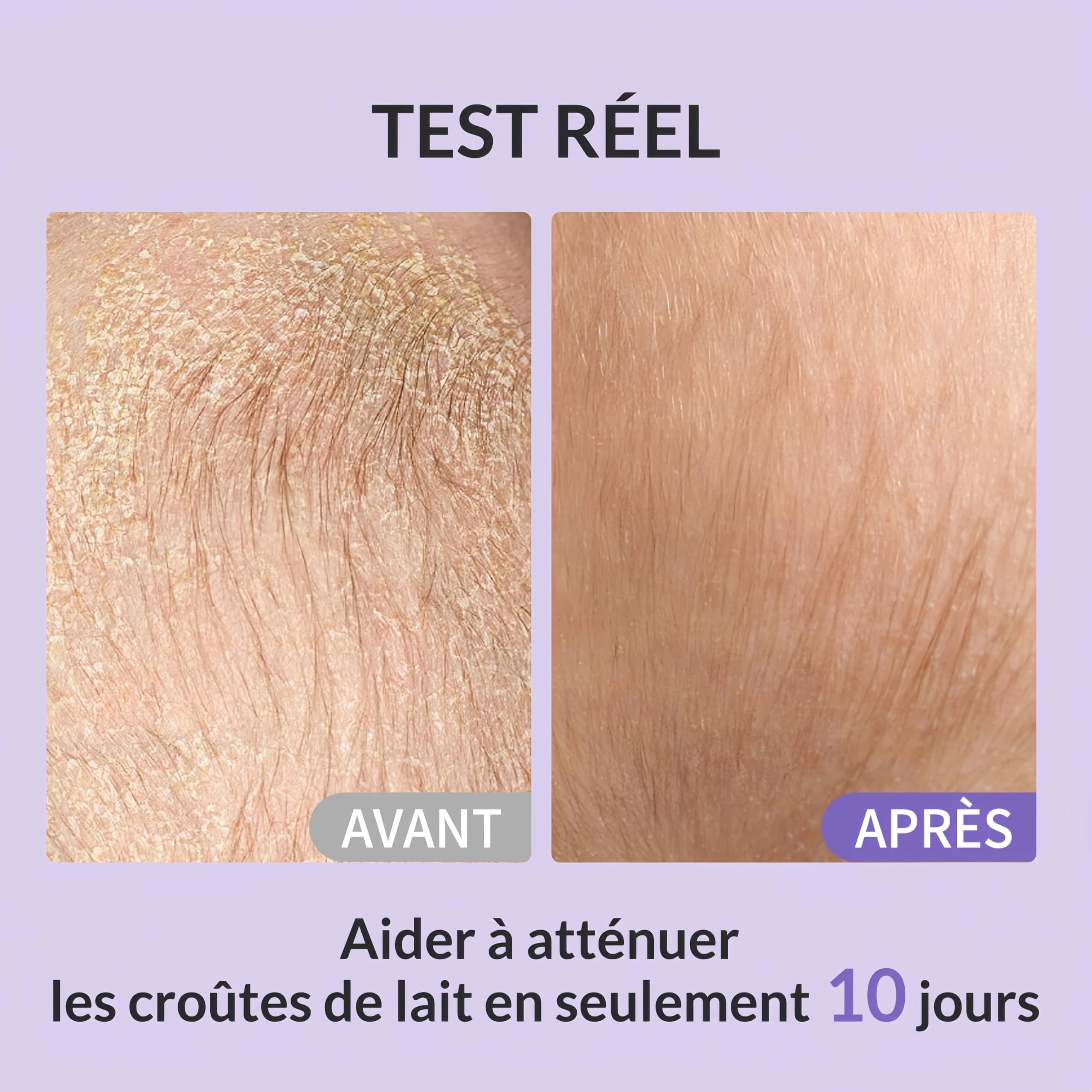 Bee Nature - Shampoing Bébé et Enfant - Croûtes de Lait - Miel Bio - Extra Doux - YUKA 100/100 - Sans Larmes - Convient aux Cuirs Chevelus Secs, Sensibles, qui Démangent et Sujets à l'Eczéma - 200ml