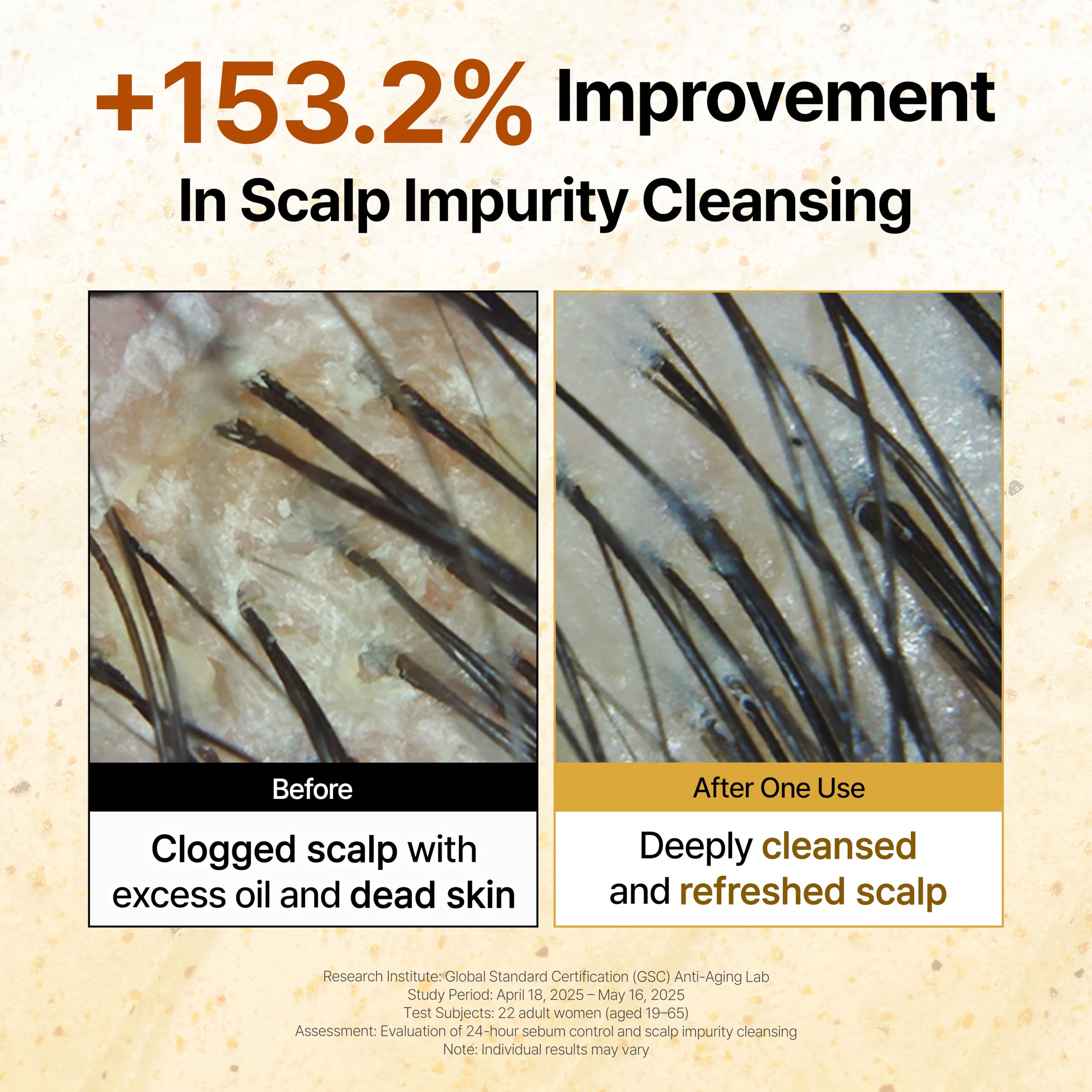 GROWUS - Shampoo Terapeutico con Sale Marino, Shampoo Chiarificante: Rimuove l'Accumulo di Prodotto, Sporco e Grasso, 16,9 fl.oz.