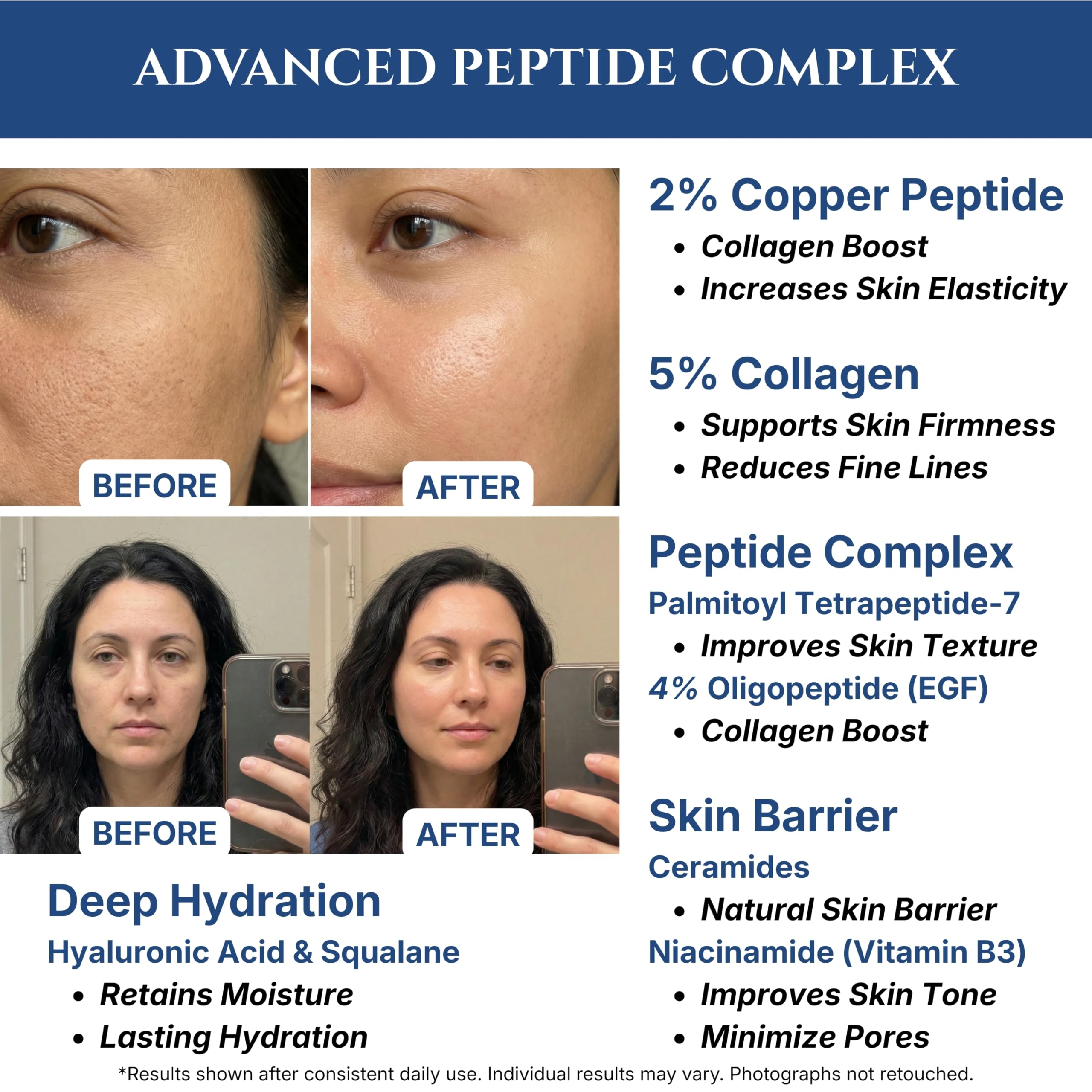 how long to see results from ghk-cu injections Copper Peptide Serum for Face, GHK Cu Copper Peptide Serum with  Niacinamide, Hyaluronic Acid and Glycerin, Copper Serum, Peptide Complex,  Paraben Free, 30ml/1 fl oz : Buy Online at Best Price in