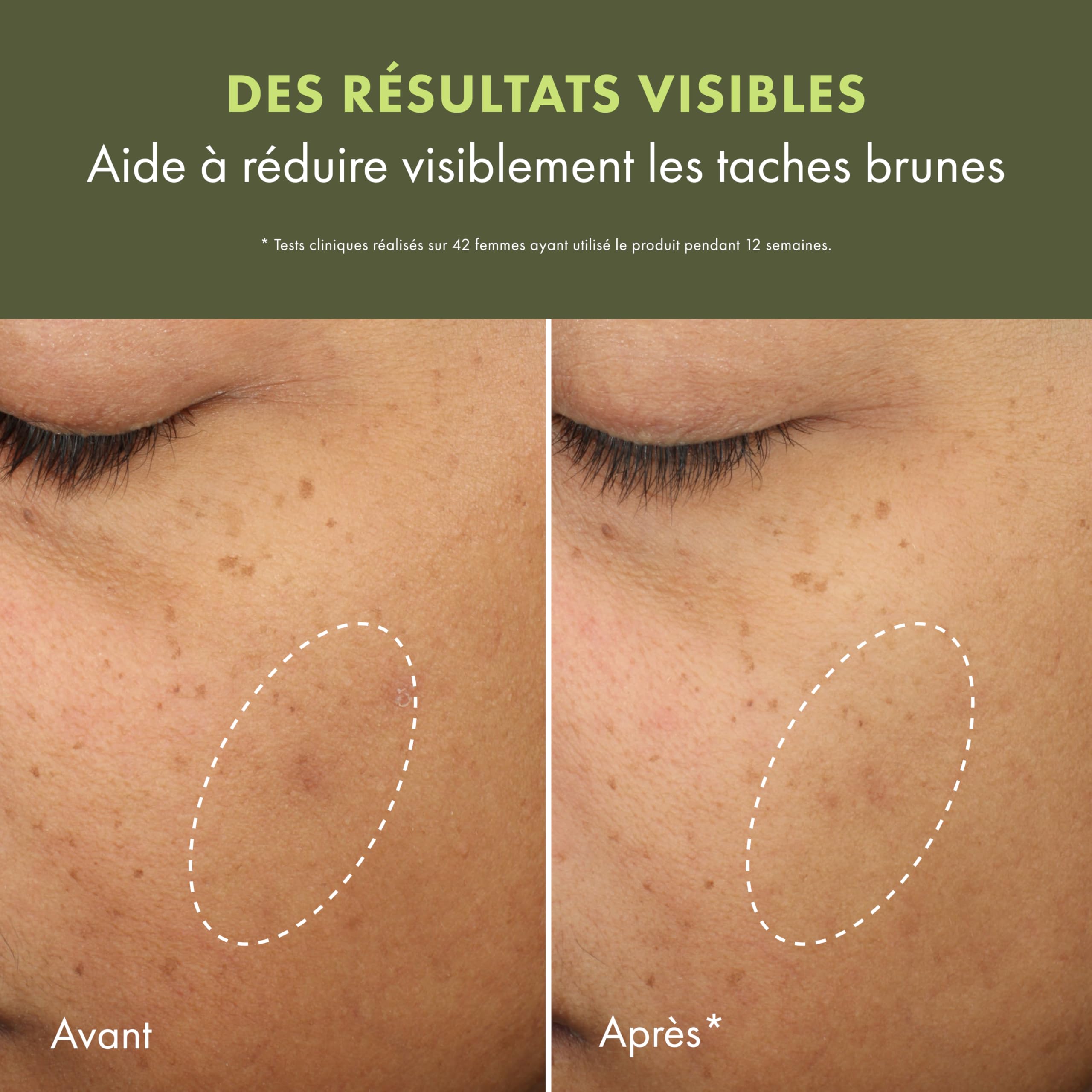 Origins Mega-Mushroom Soin Hydratant Correcteur Anti-Taches, Réduit l’hyperpigmentation visible et les marques post-acné, Contient de la vitamine C et du champignon Reishi, 50 ml