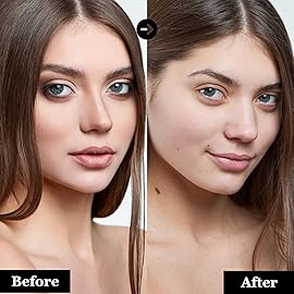 mivida Hypoallergenic Makeup Remover Wipes with Hyaluronic Acid, Alcohol Free & Fragrance Free Makeup Wipes For Sensitive skin, Plant Based Make Up Remover, Travel Friendly 25 Count