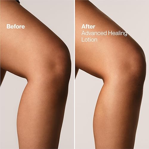 Miniatura 7 de Suave + Loción curativa avanzada para manos y cuerpo para mujeres con ceramidas para piel muy seca, hidratante, no grasosa, crema hidratante sin