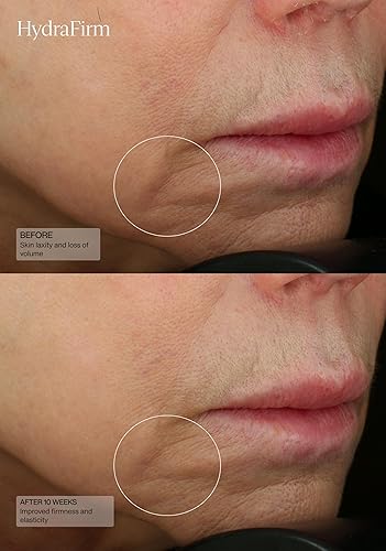 Miniatura 6 de Senté HydraFirm Serum  Apoya la producción de colágeno y elastina  Restaura la firmeza y rellena la piel  Formulado con HSA y péptidos patentados  1