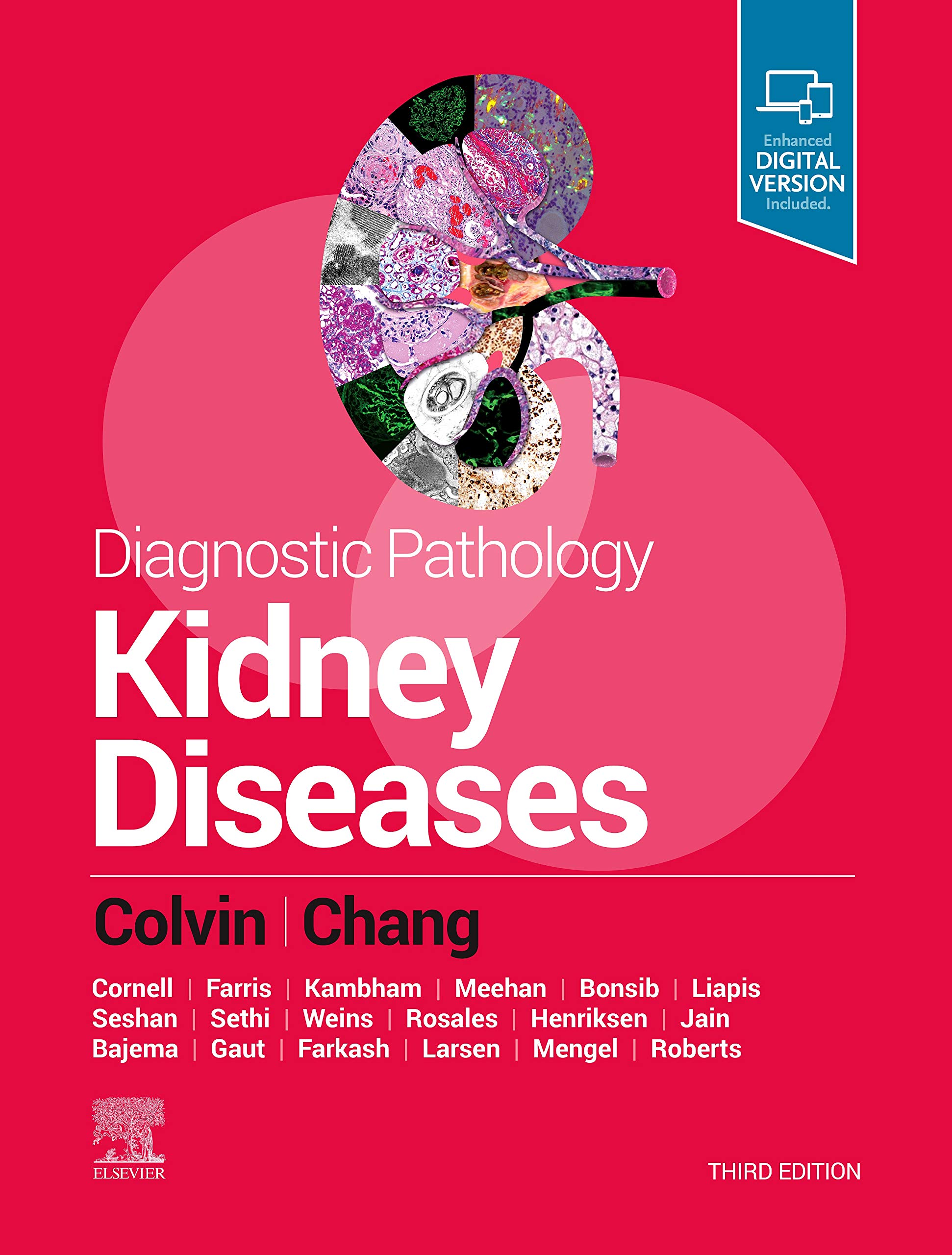 健康・医学 Diagnostic Pathology Kidney Diseases 3rd 81smJ8EJVNL.jpg