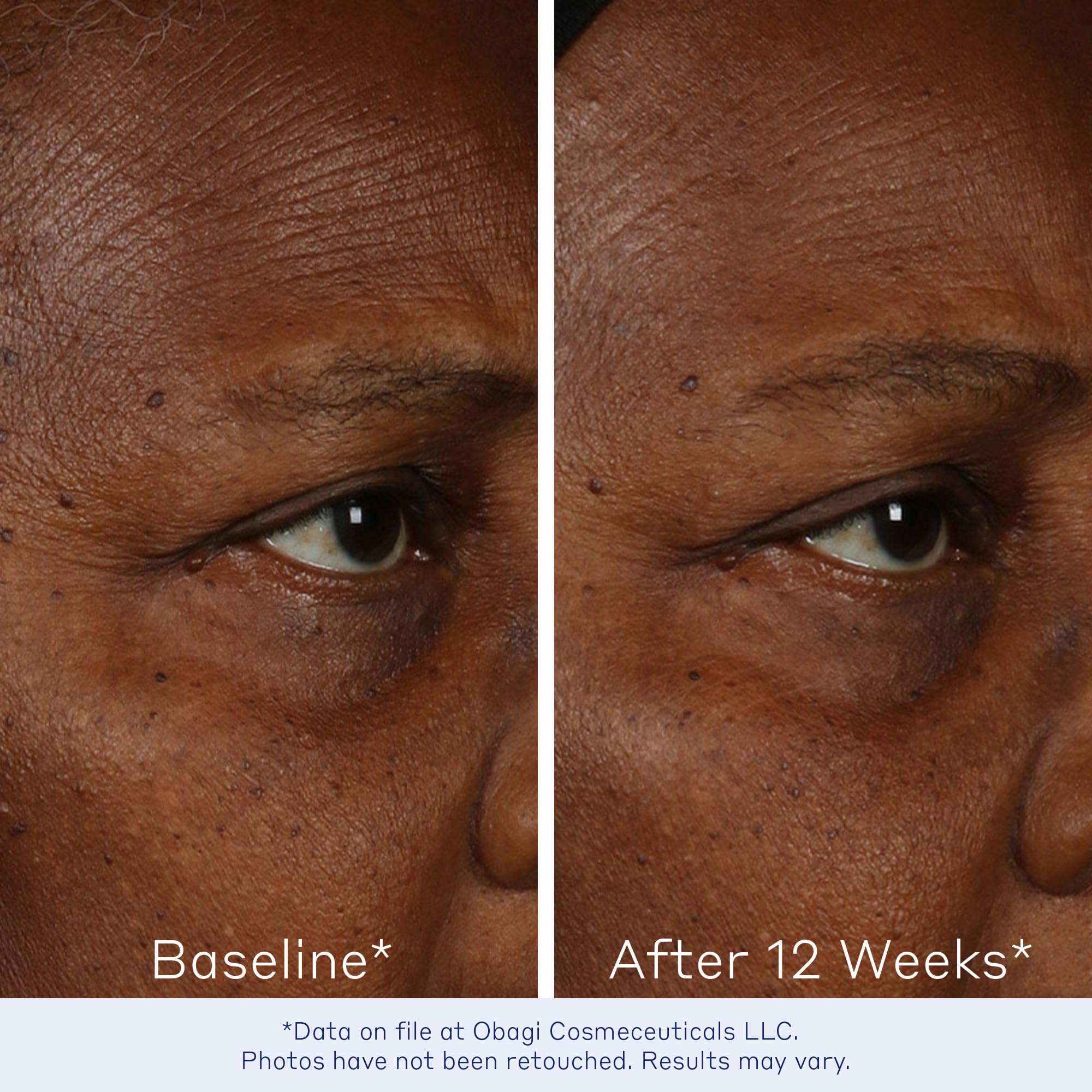 Obagi ELASTIderm Facial Serum – Firming Face Serum with Patented Bi-Mineral Contour Complex Clinically Proven to Target Signs Of Skin Aging