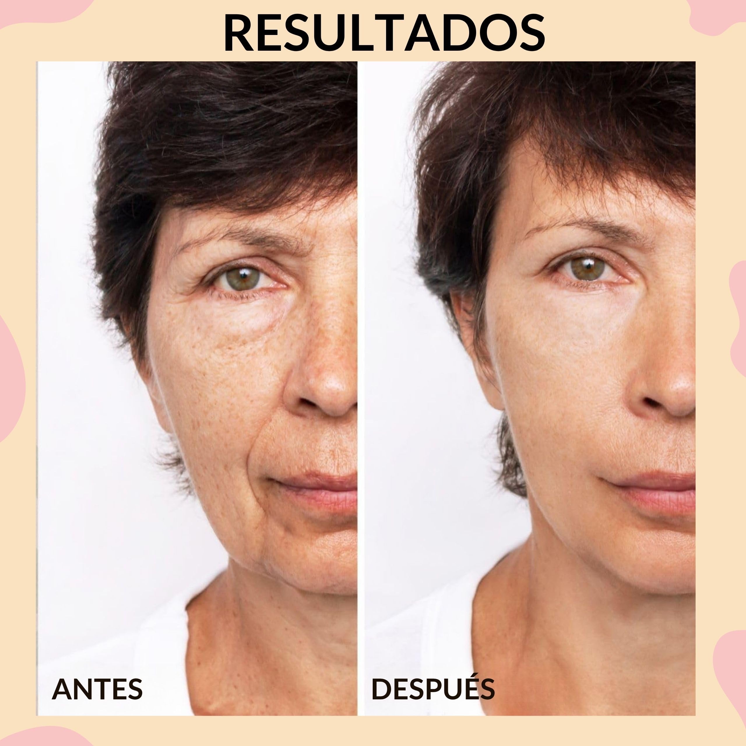 Radiofrecuencia Facial 6 en 1 - Alta Frecuencia Luz Roja LED y Limpieza Facial - Aparato Antiarrugas - 3 Luces LED Naranja Azul y Roja - 6 Modos Diferentes - Especial Ojos Cara y Cuello