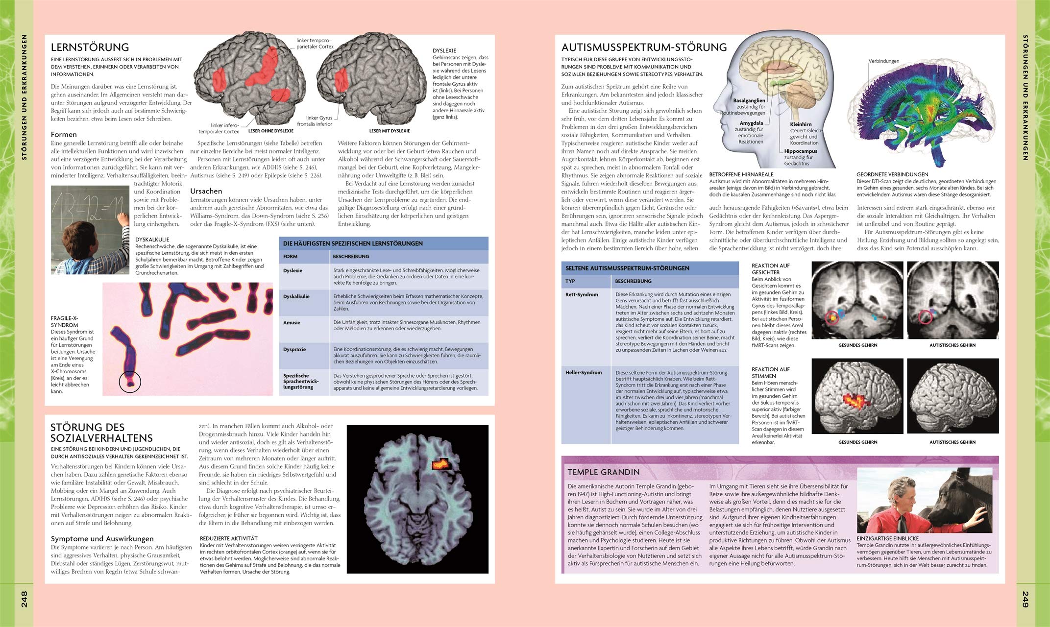 Das Gehirn: Anatomie, Sinneswahrnehmung, Gedächtnis, Bewusstsein, Störungen. Aktualisierte Neuausgabe