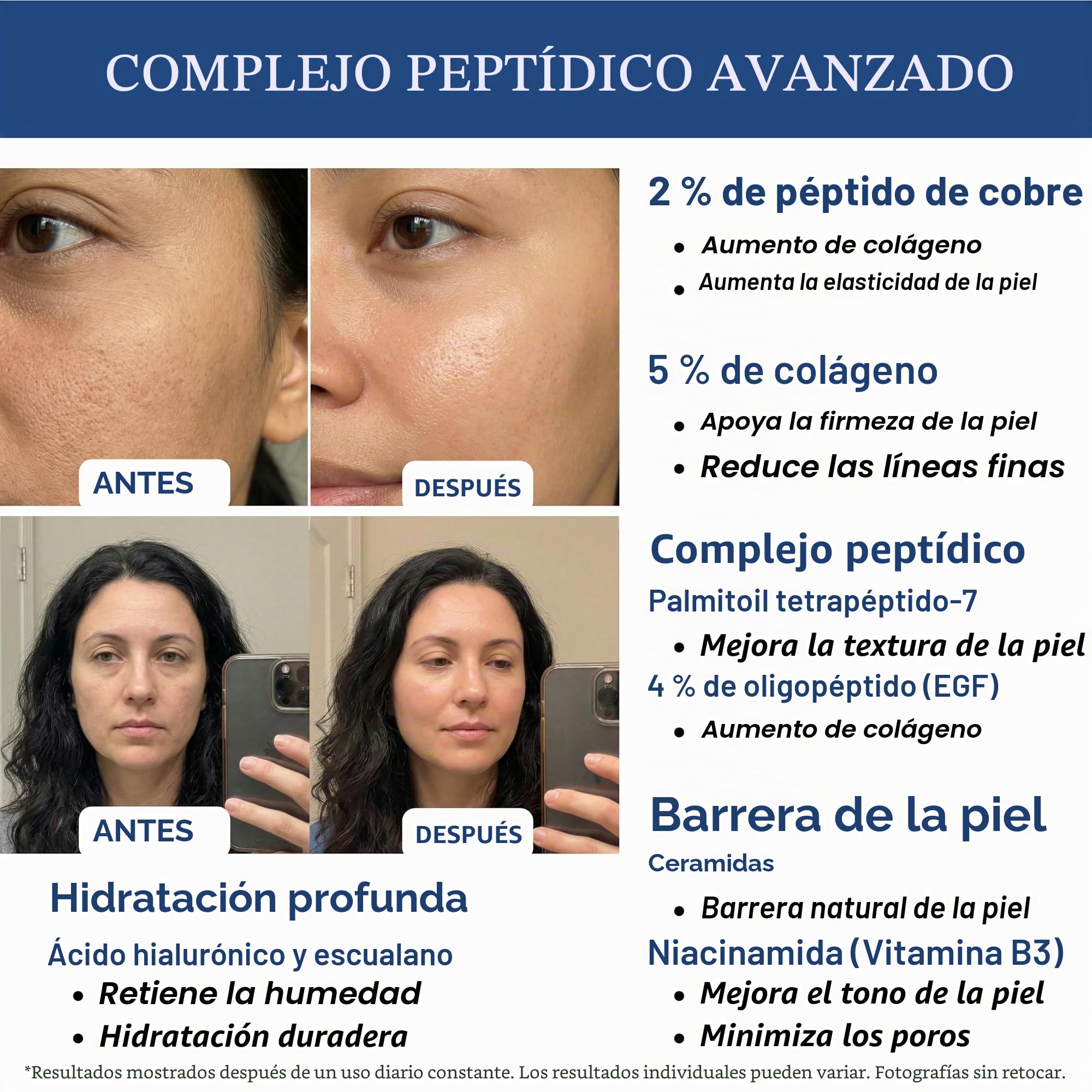 Suero de Péptidos de Cobre para la Cara, Suero de Péptido de Cobre GHK con Niacinamida, Ácido Hialurónico y Glicerina, Suero de Cobre, Complejo de Péptidos, Libre de Parabenos, 30 ml / 1 oz Líquido
