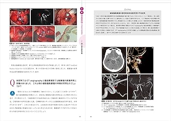 脳神経外科 脳血管障害の包括的治療選択 再発・合併症・難症例から学ぶ 脳血管障害の包括的治療選択 再発・合併症・難症例から学ぶ