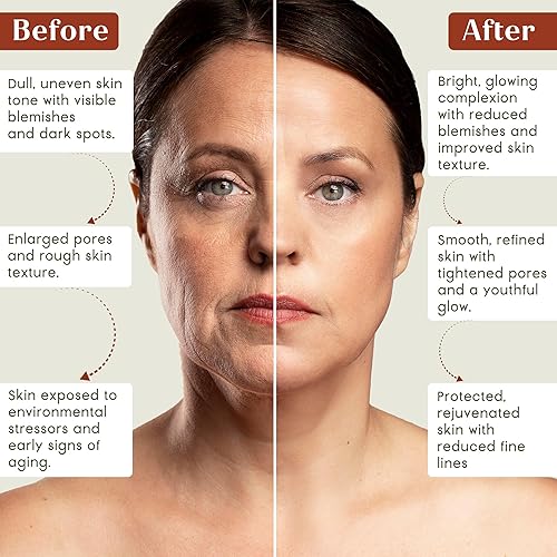 Miniatura 8 de Mascarilla facial de cúrcuma y sándalo de prana  Cuidado natural de la piel  Aclarador e hidratante  Antienvejecimiento  Mascarilla facial de