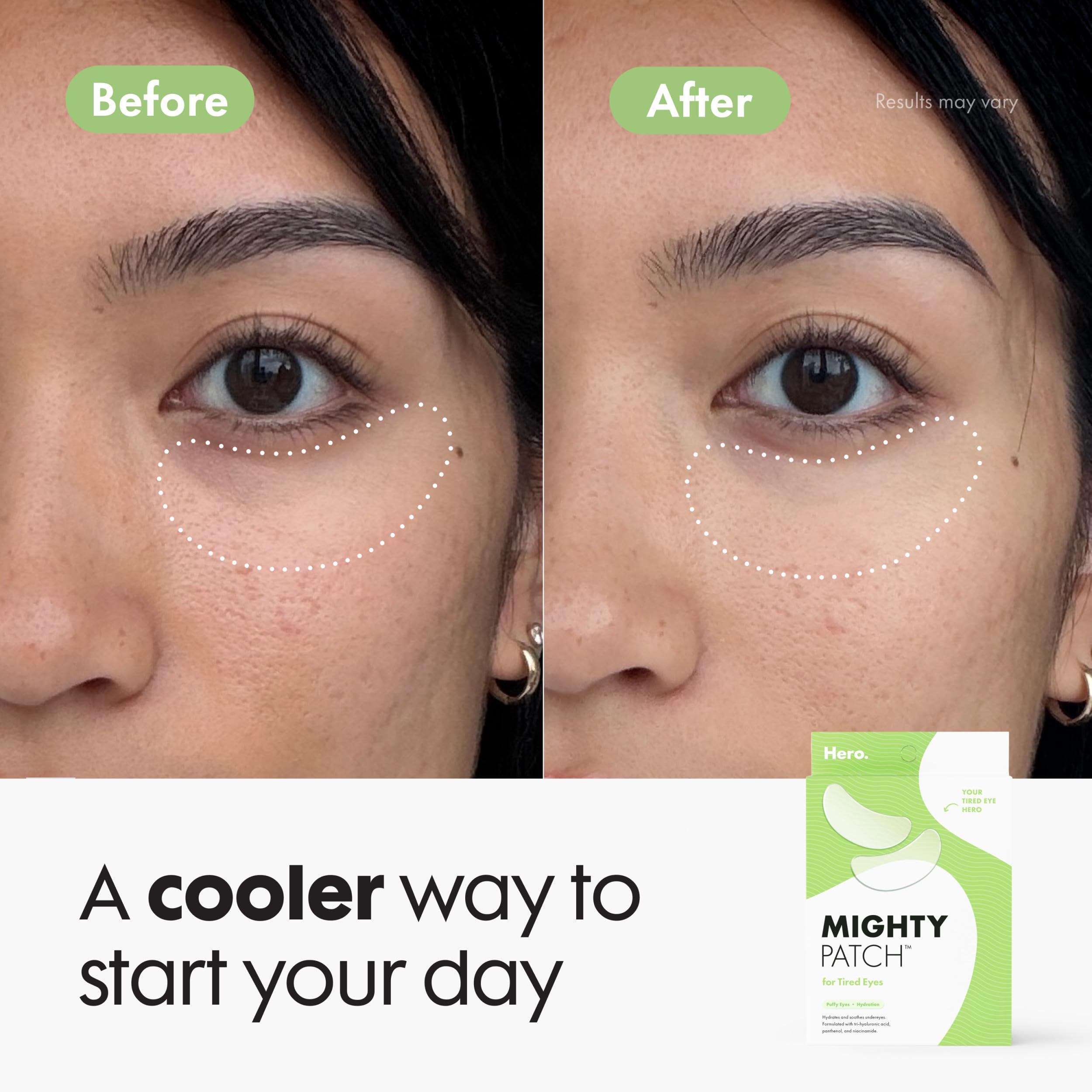 Mighty Patch for Tired Eyes - Reduce Puffiness & Bags -3 Mighty Patch for Tired Eyes - Reduce Puffiness & Bags -3