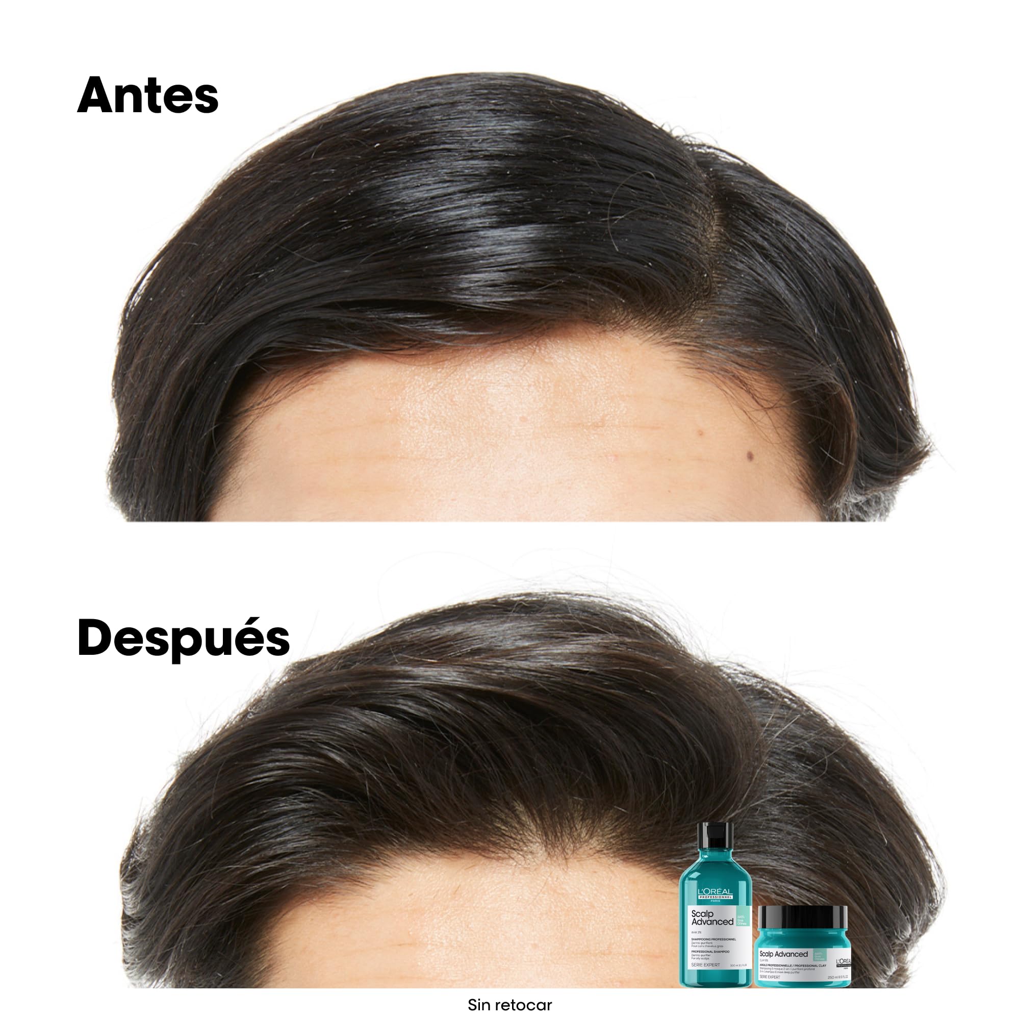 L’Oréal Professionnel, Champú Pelo Graso y Arcilla, con Activos Dermatológicos, Champú Antigrasa, Diseñador para Pelo Graso y Fino, Scalp Advanced, 250 ml