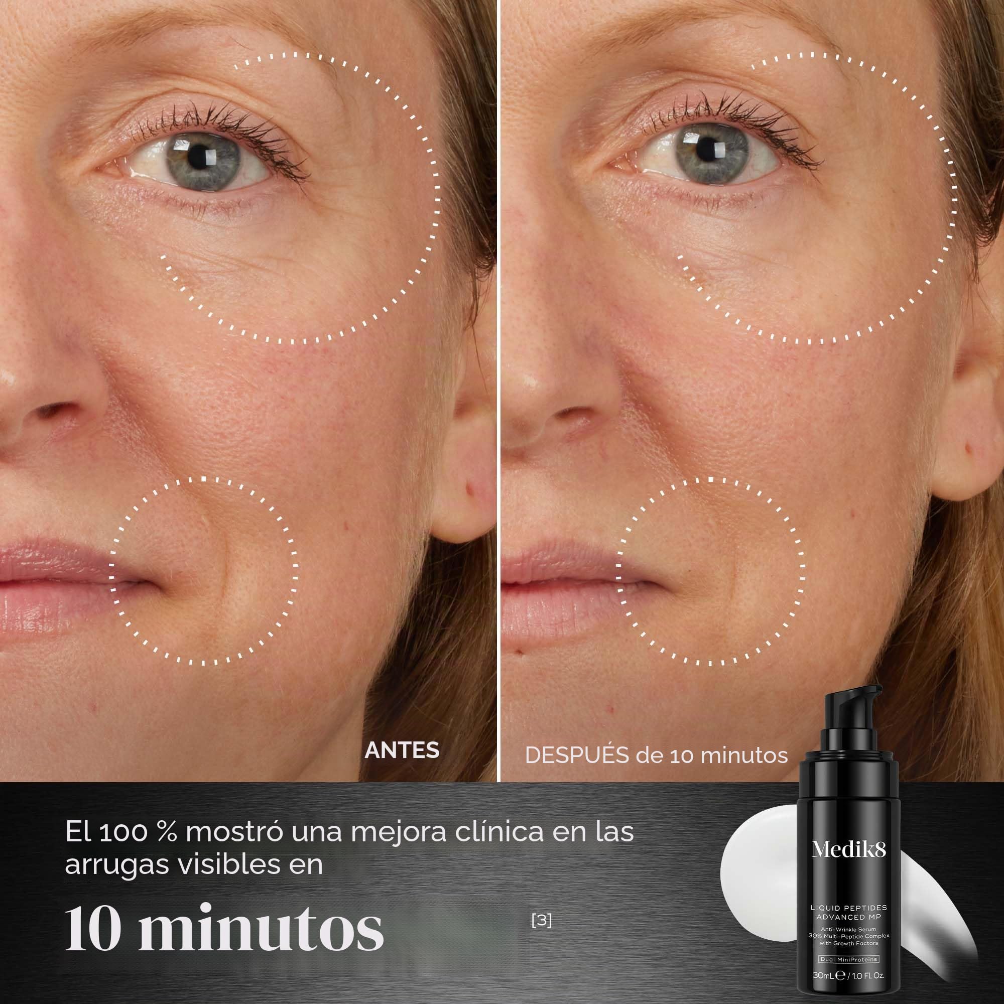 Medik8 Liquid Peptides Advanced MP – Con tecnología biotecnológica innovadora, Dual MiniProteins – 30% de complejo multipéptido – 30 ml