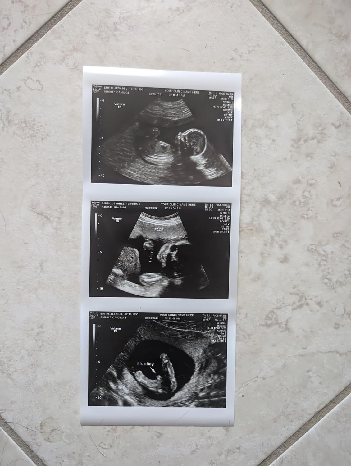 Prank 2D Customized Fake Ultrasound Strip of 3 Photos