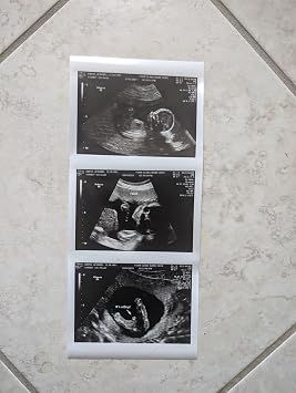 Prank 2D Customized Fake Ultrasound Strip of 3 Photos